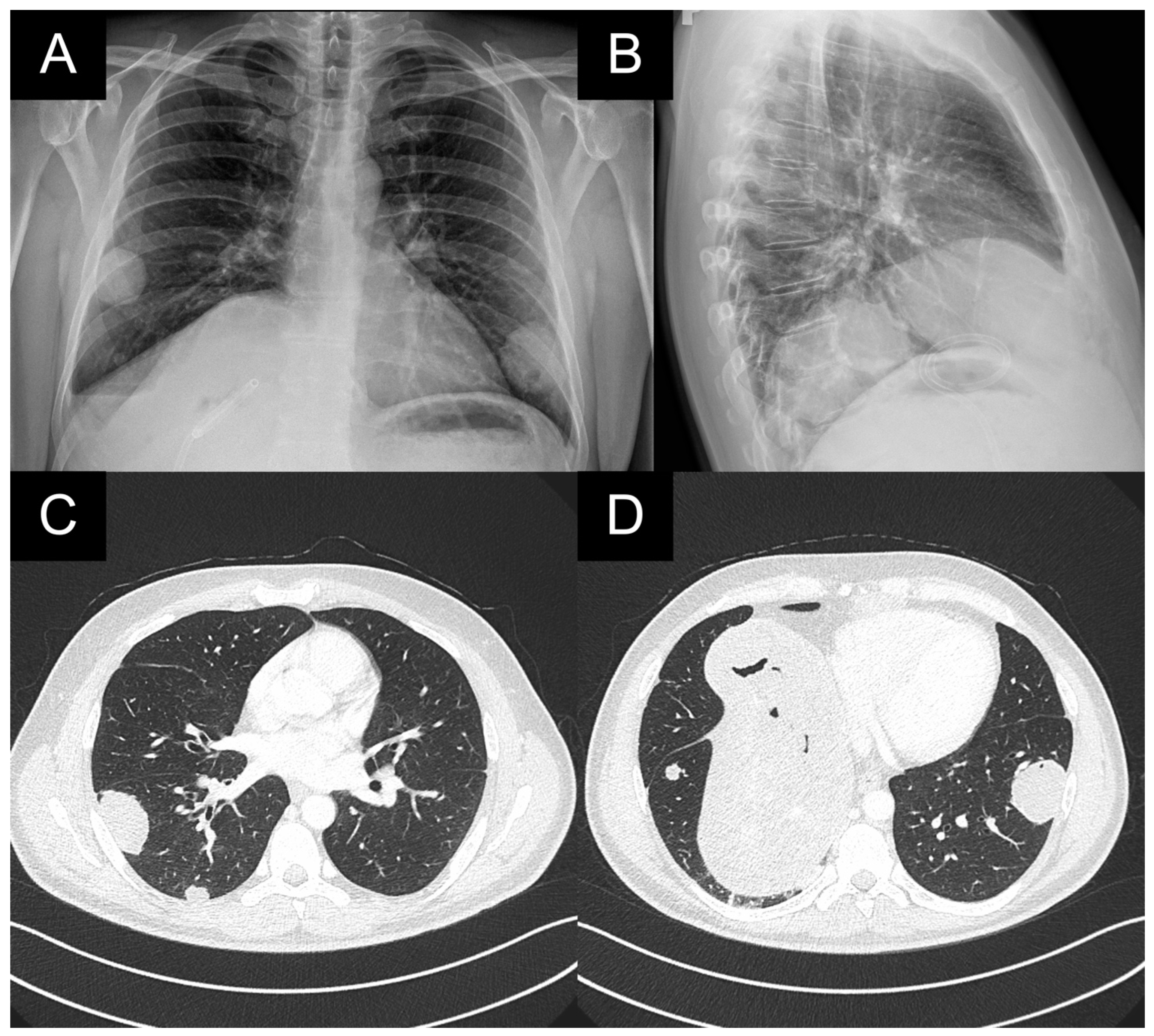 Medicina 59 00543 g002
