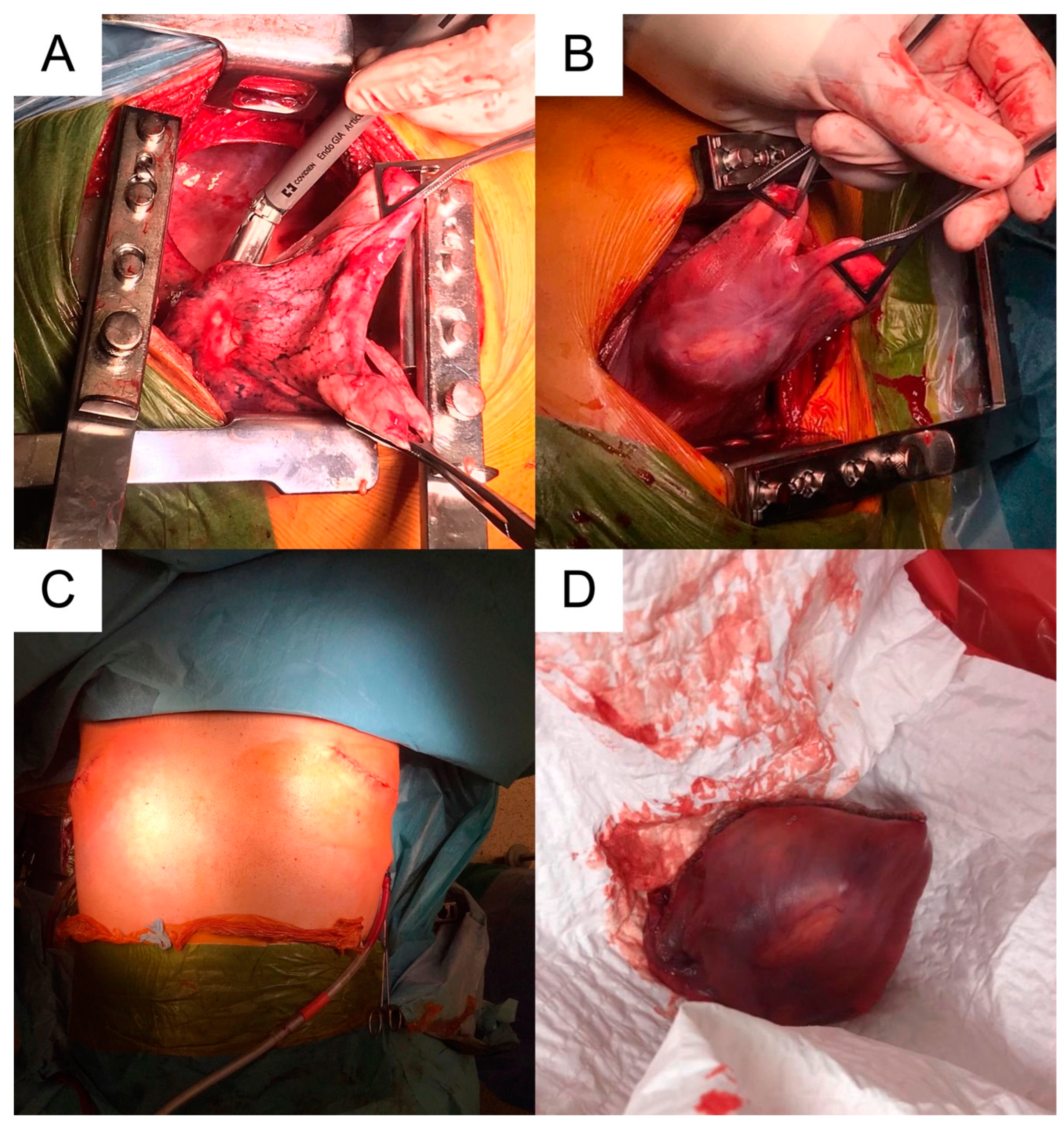 Medicina 59 00543 g003