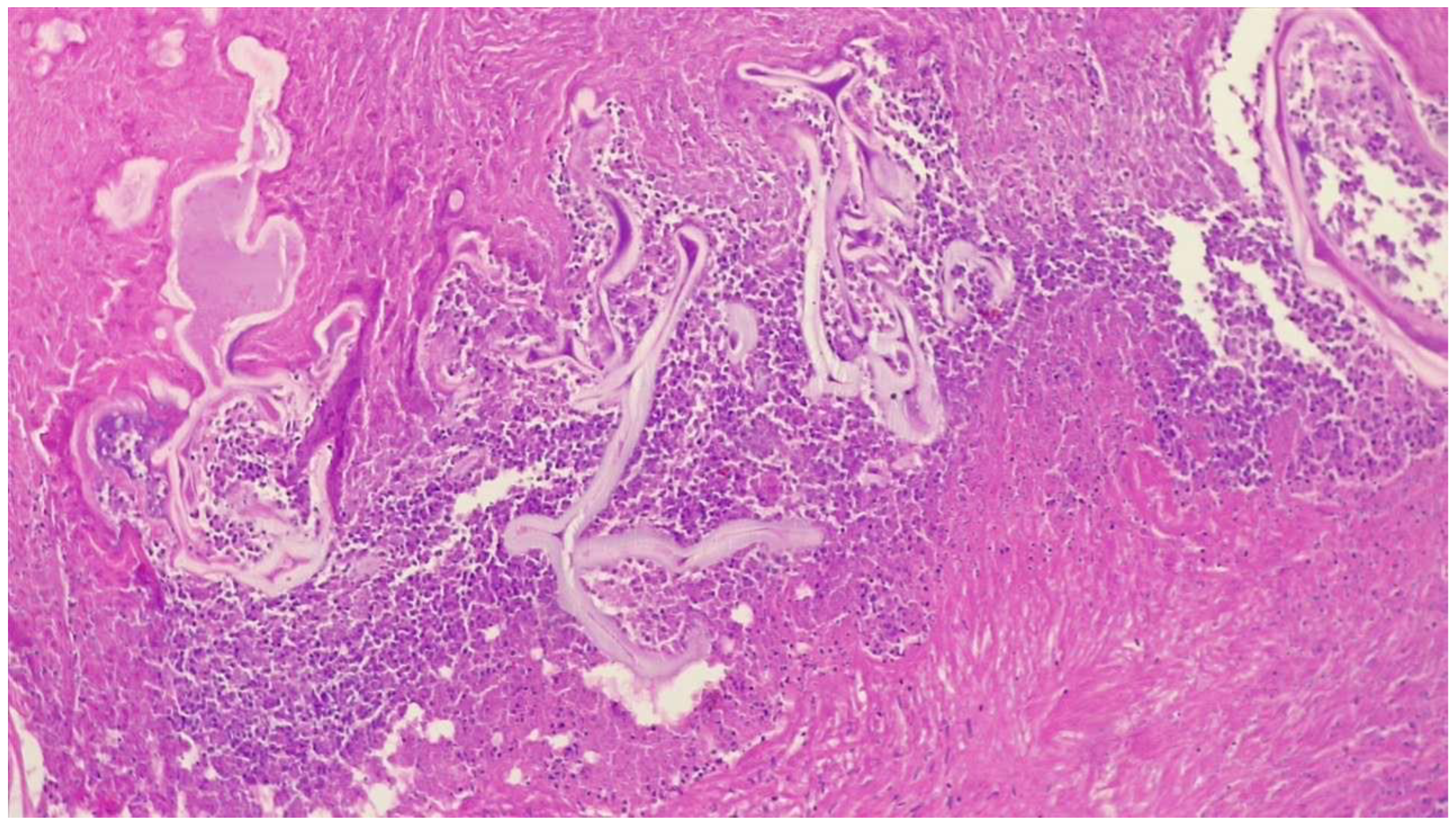 Medicina 59 00543 g004