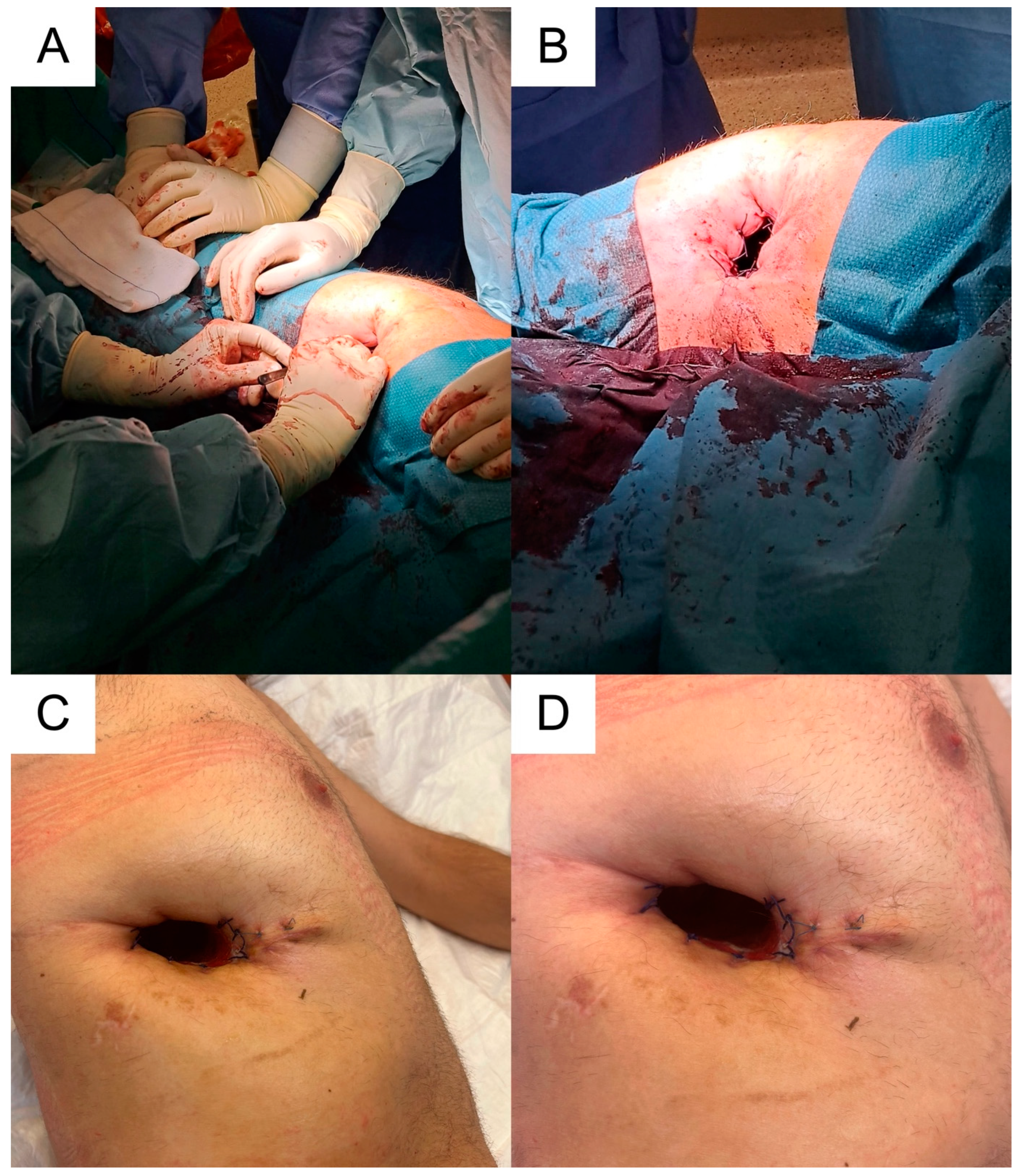 Medicina 59 00543 g006