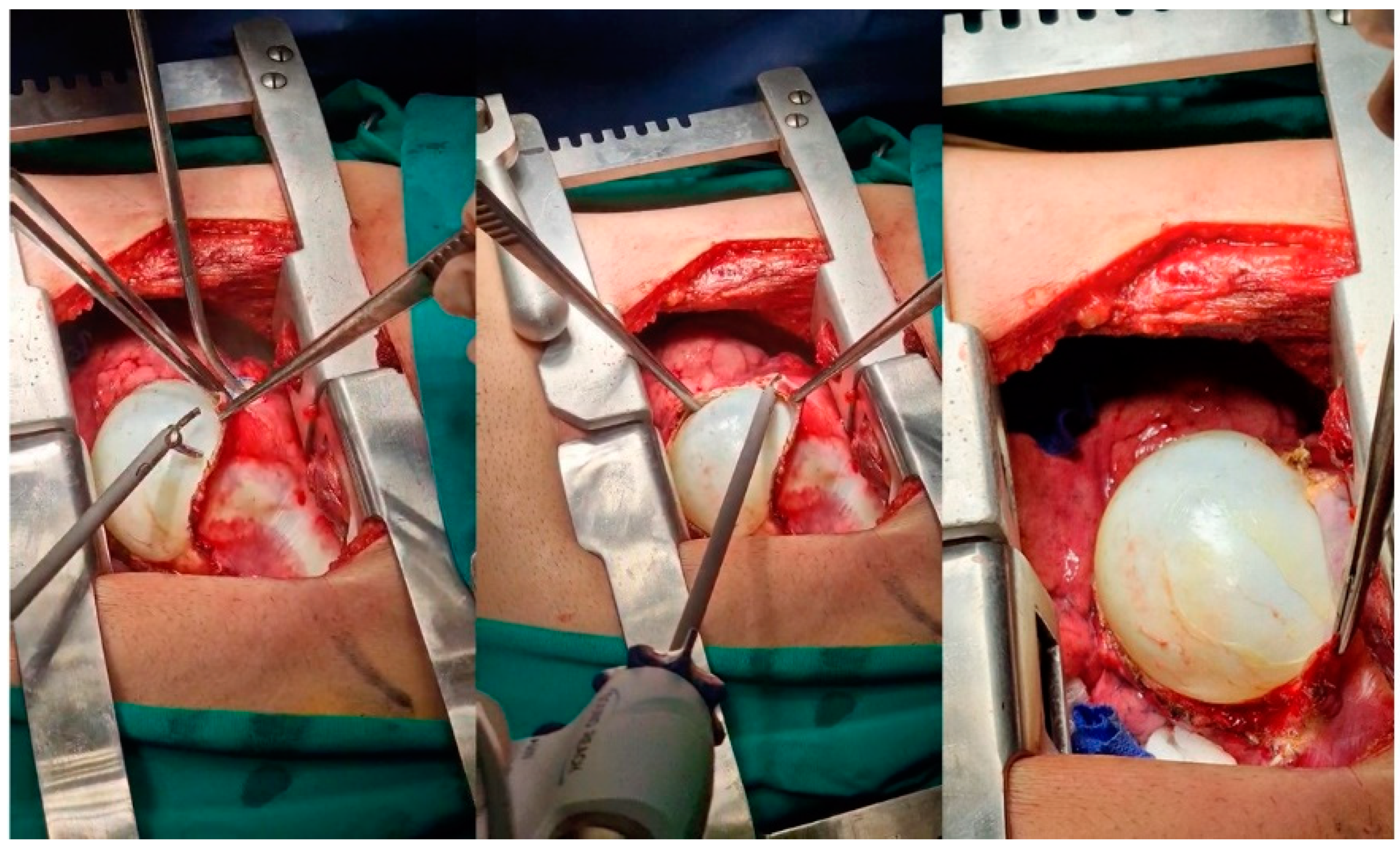 Medicina 59 00543 g008