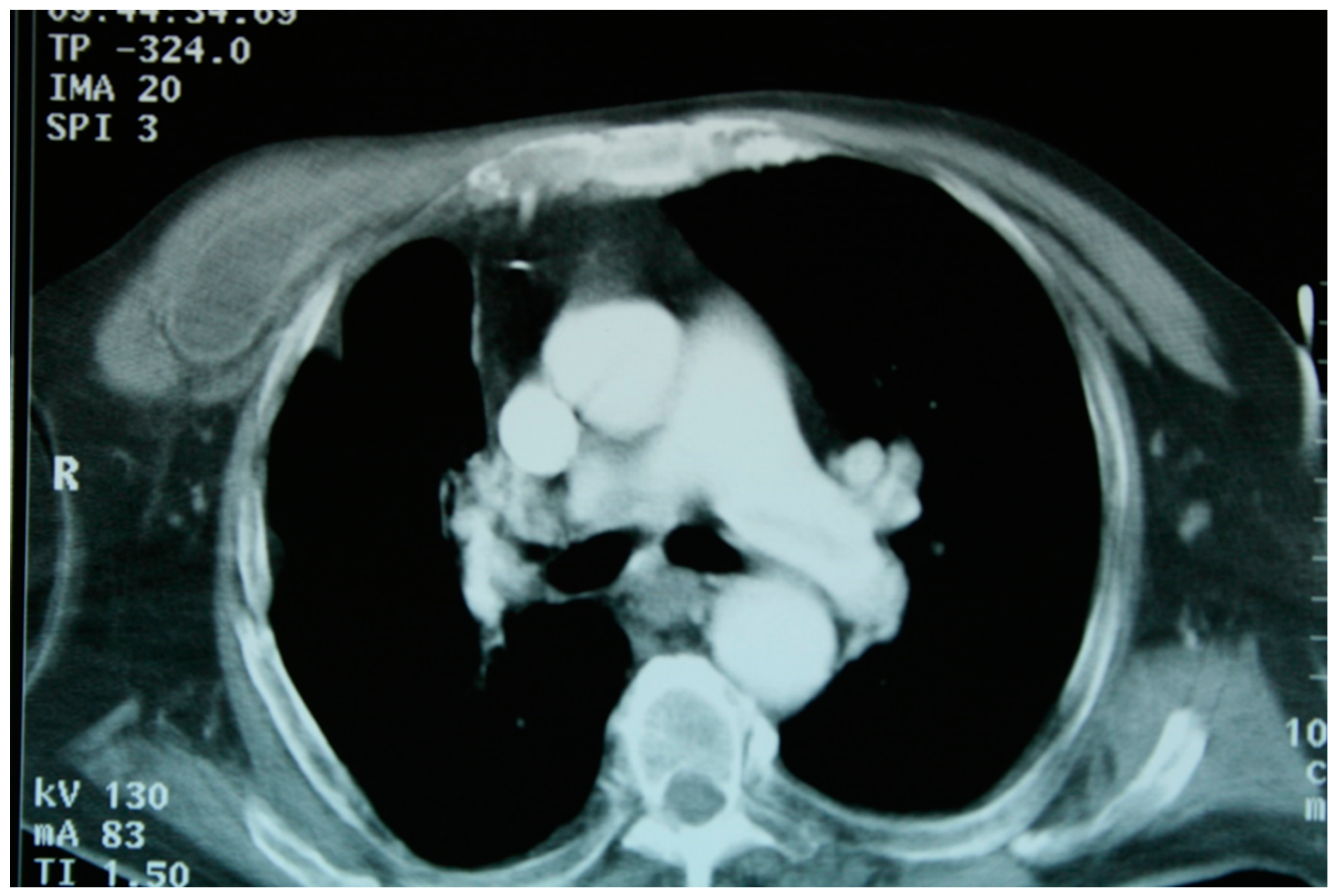 Medicina 59 00543 g009