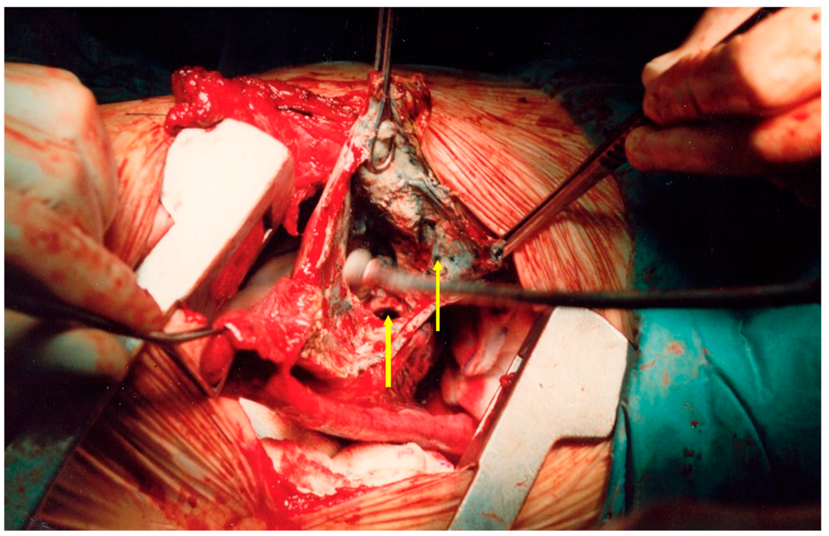 Medicina 59 00543 g011