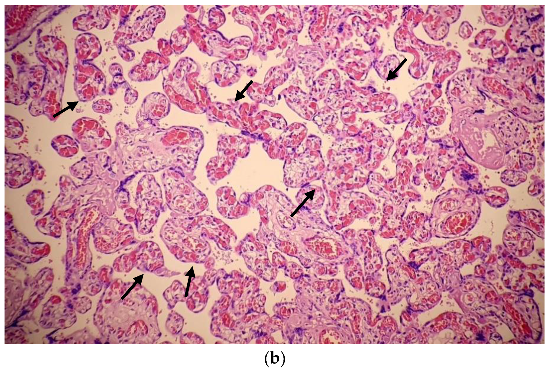 Medicina 59 00552 g001b