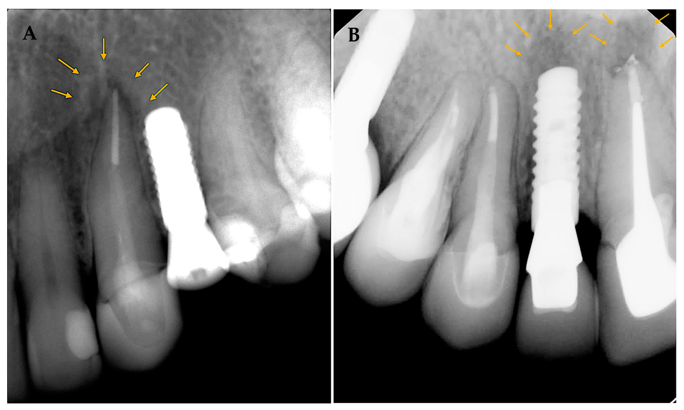 Medicina 59 00560 g003