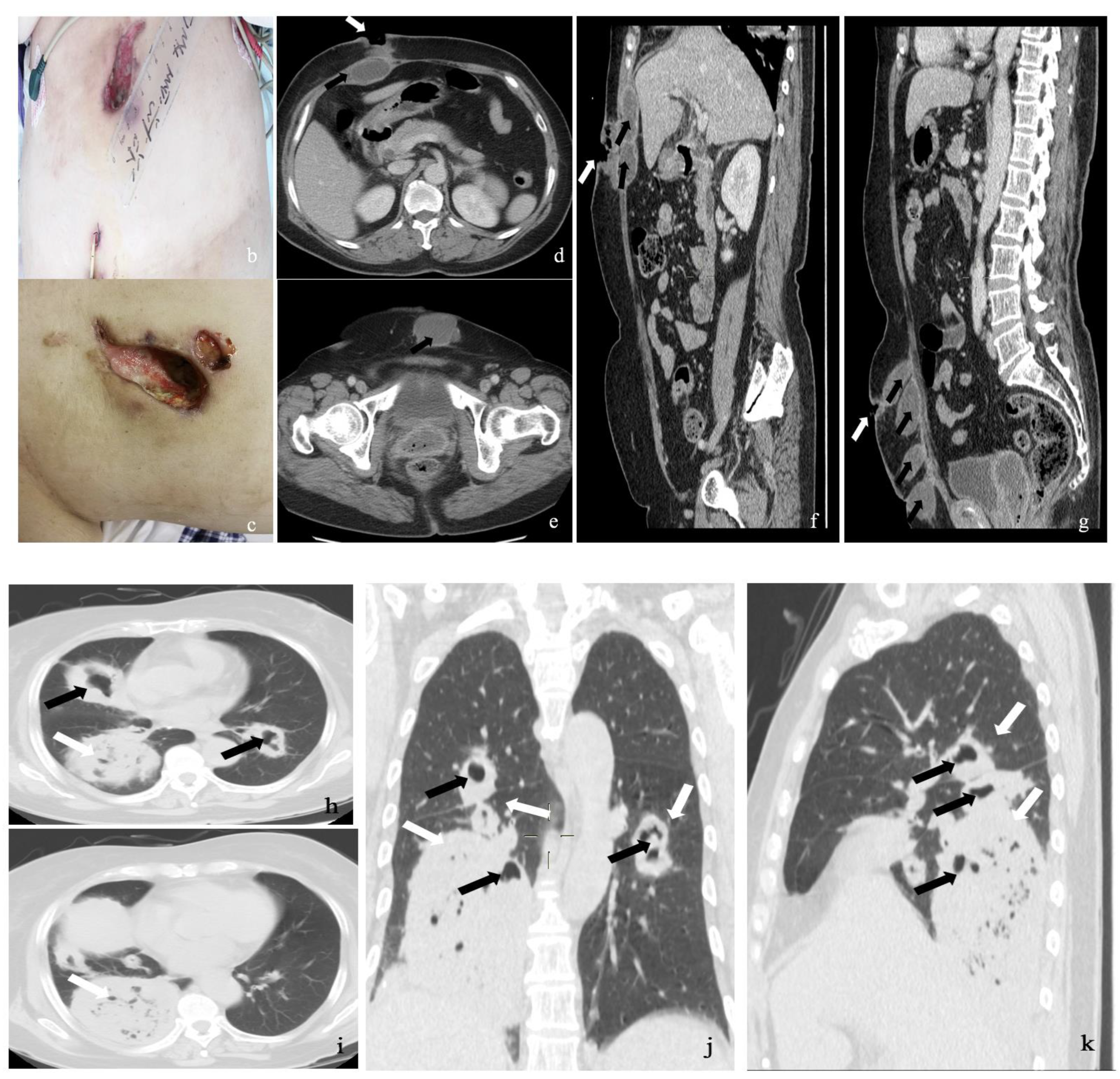 Medicina 59 00563 g001b Medicina 59 00563 g001b