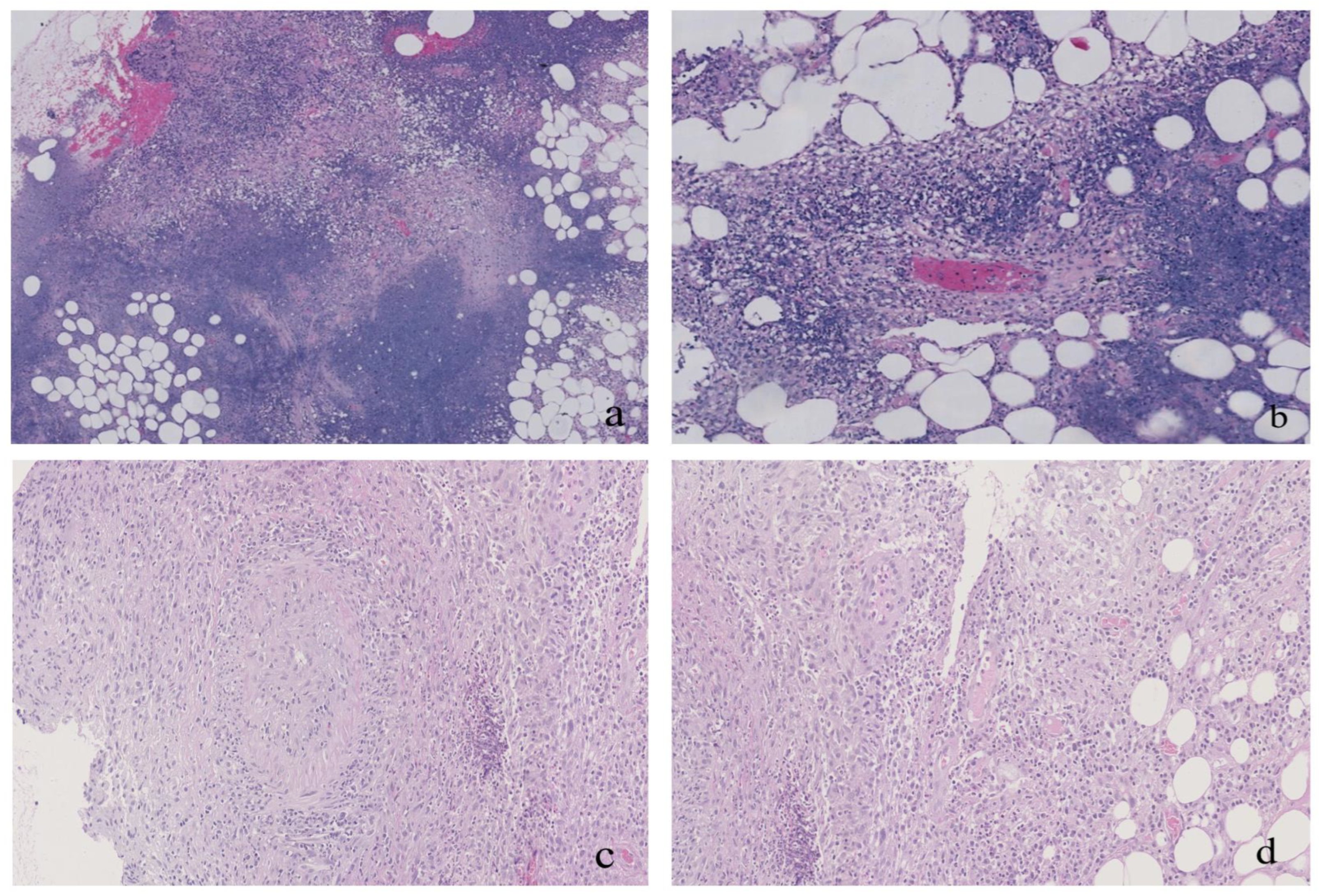Medicina 59 00563 g002 Medicina 59 00563 g002
