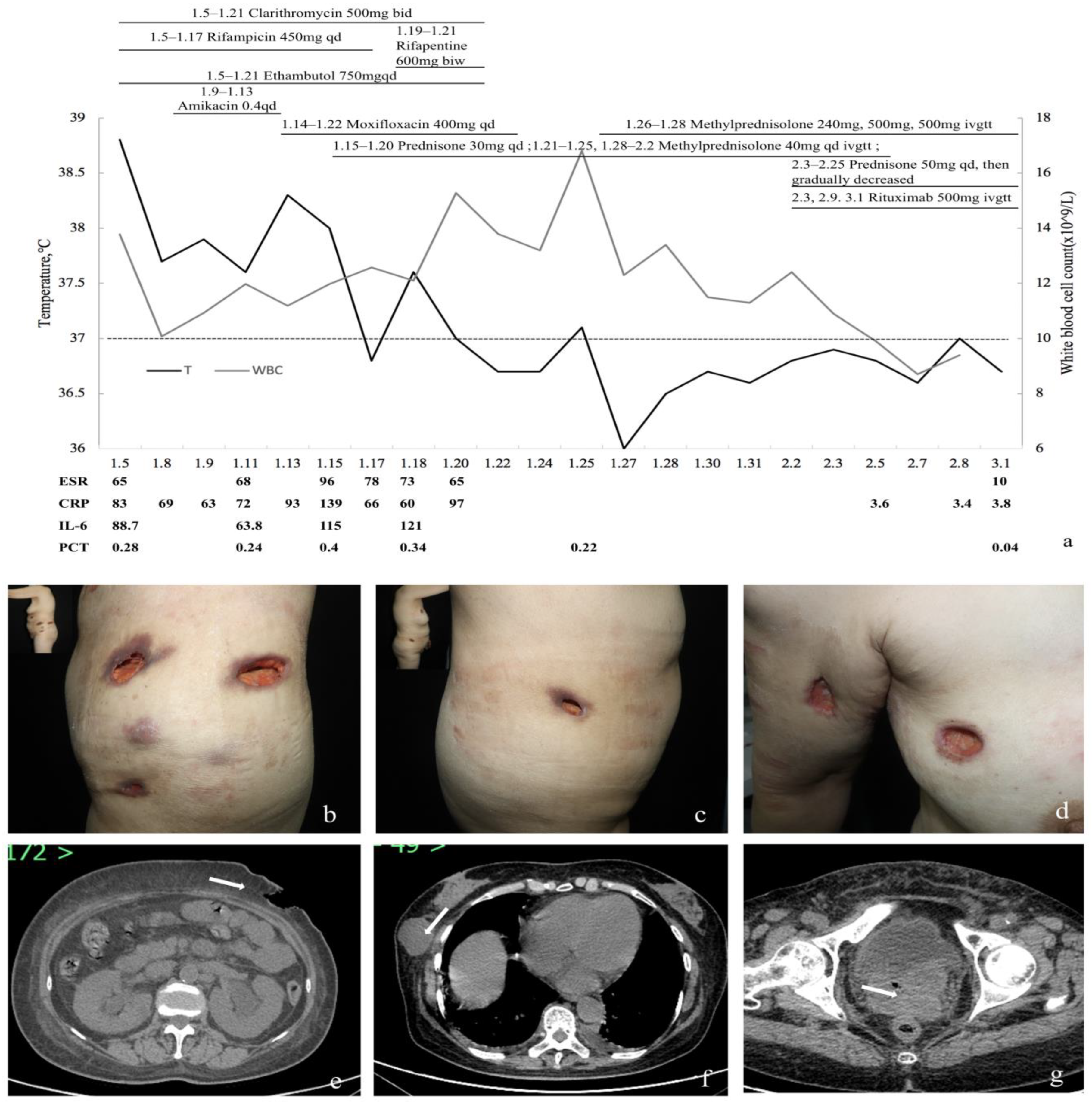 Medicina 59 00563 g003 Medicina 59 00563 g003