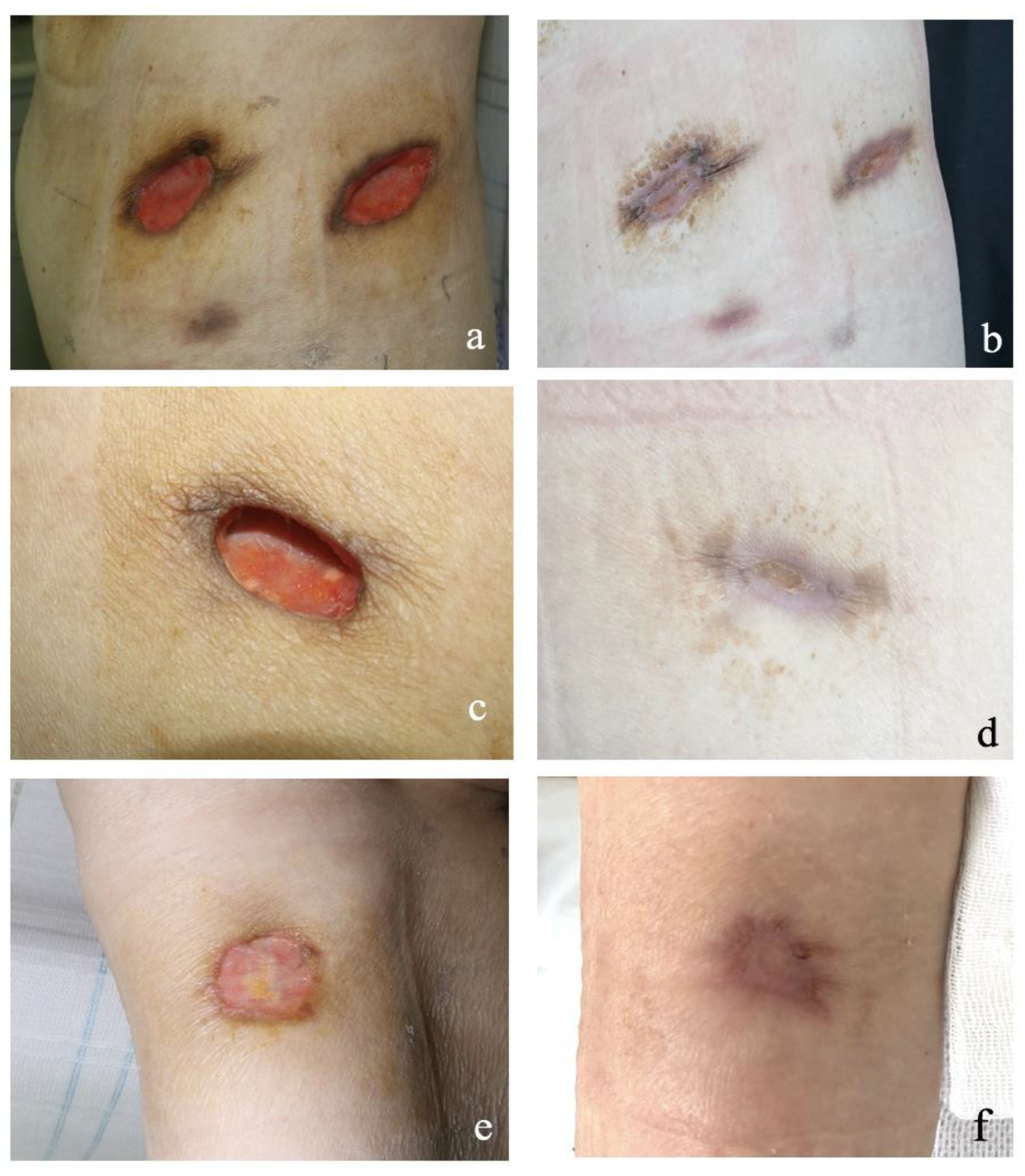 Medicina 59 00563 g004 Medicina 59 00563 g004