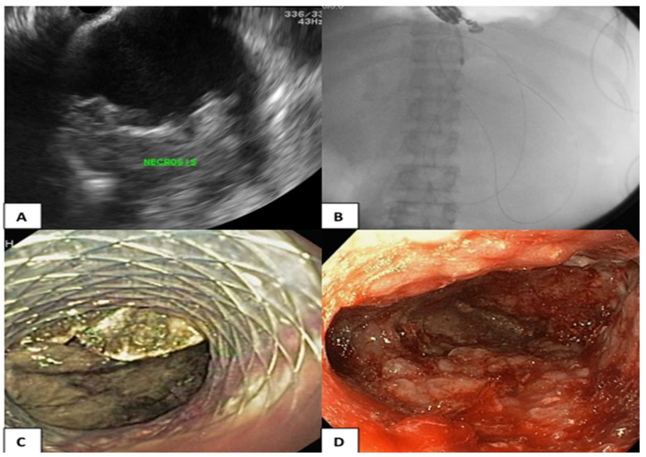 Medicina 59 00569 g002