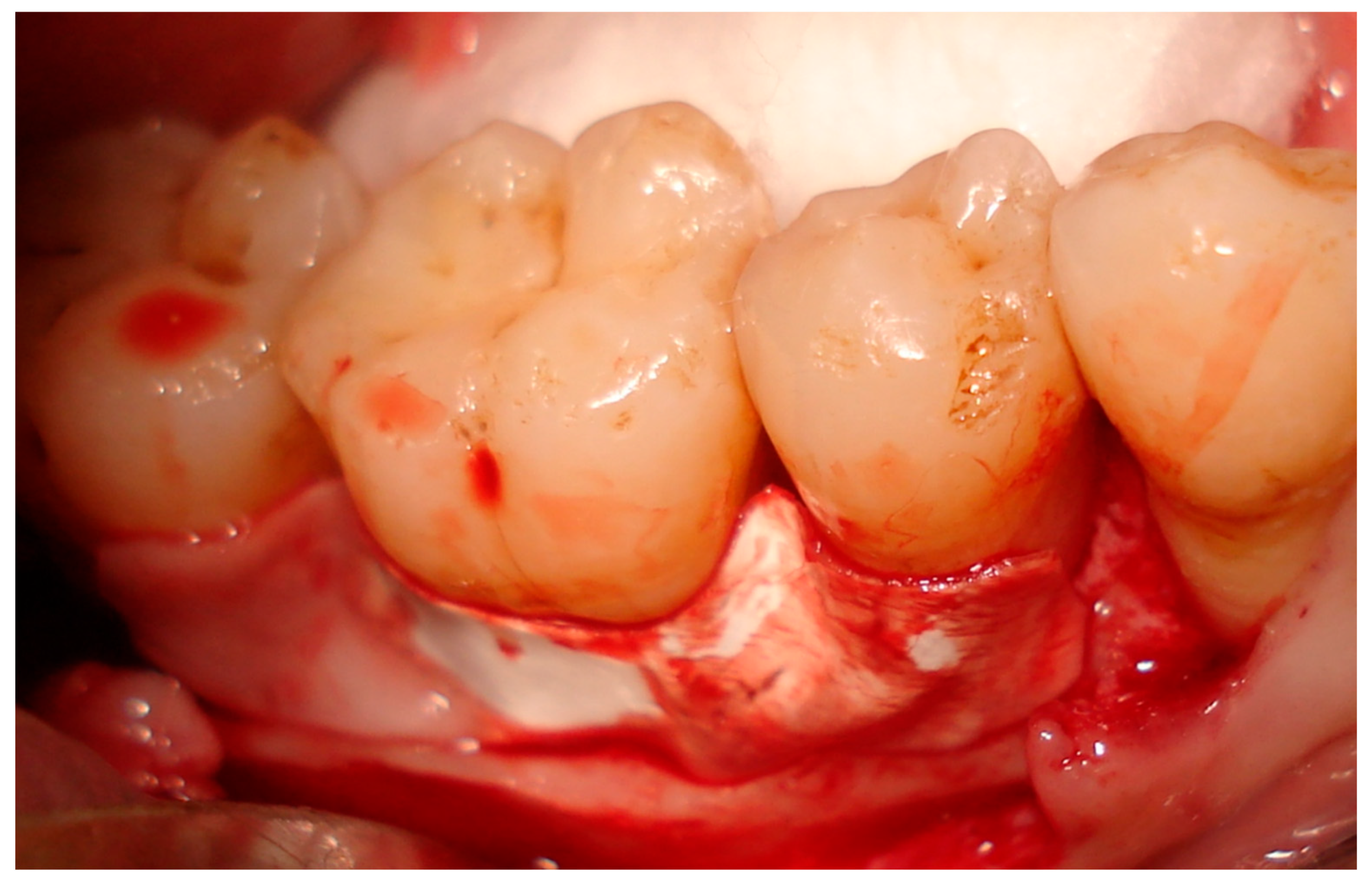 Medicina 59 00572 g002 Medicina 59 00572 g002