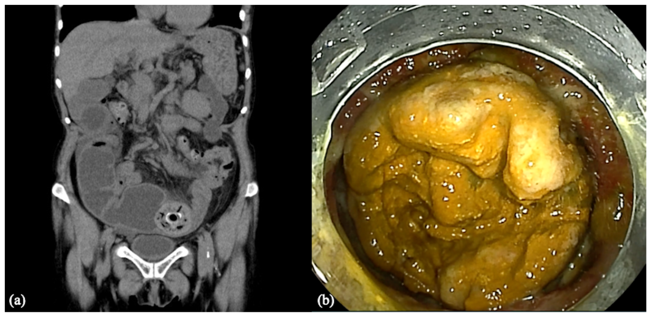 Medicina 59 00573 g001