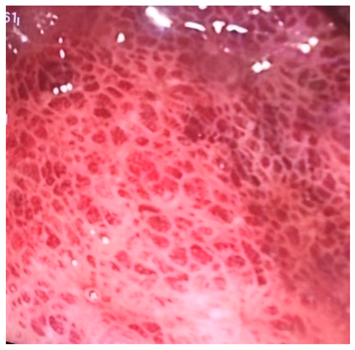 Medicina 59 00576 g001 550