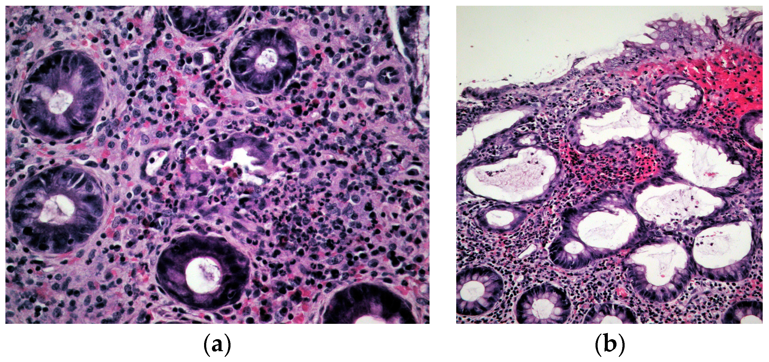 Medicina 59 00576 g002 550