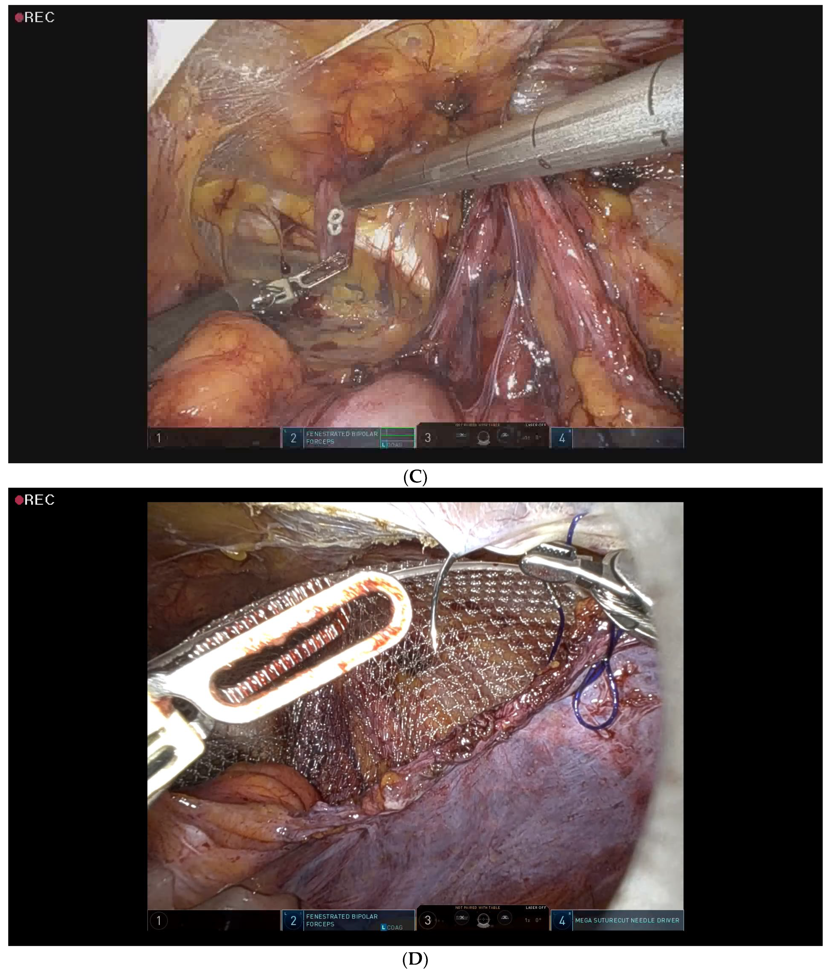Medicina 59 00582 g003b