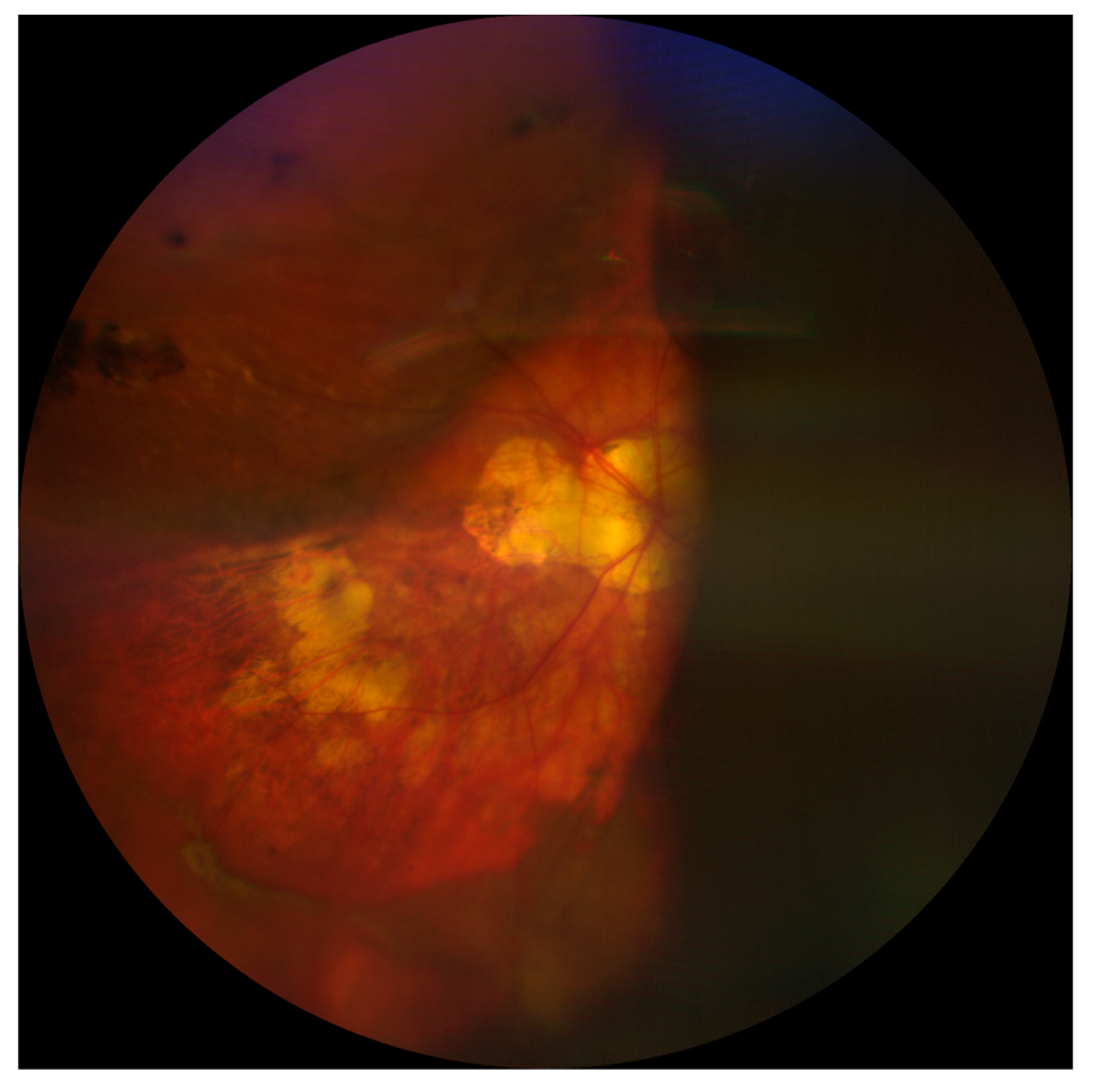 Medicina 59 00583 g002