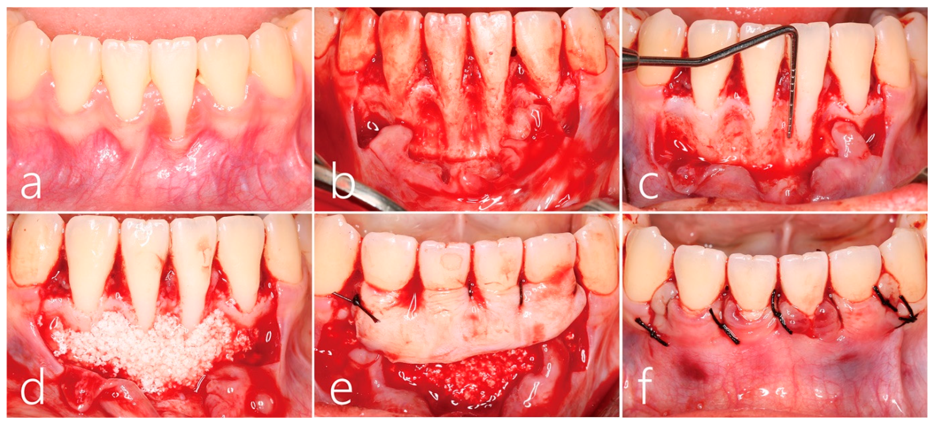 Medicina 59 00584 g002 Medicina 59 00584 g002