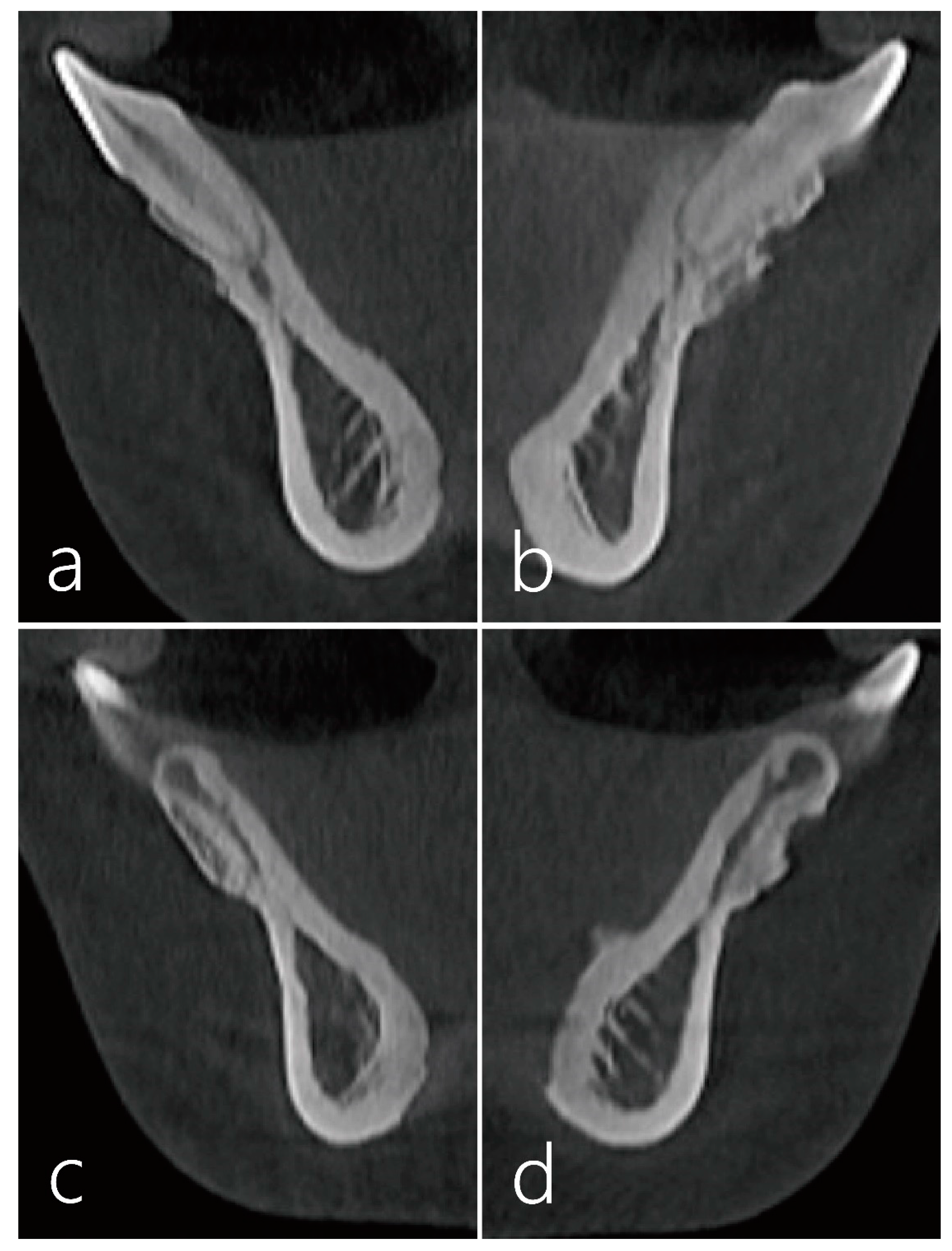 Medicina 59 00584 g004 Medicina 59 00584 g004