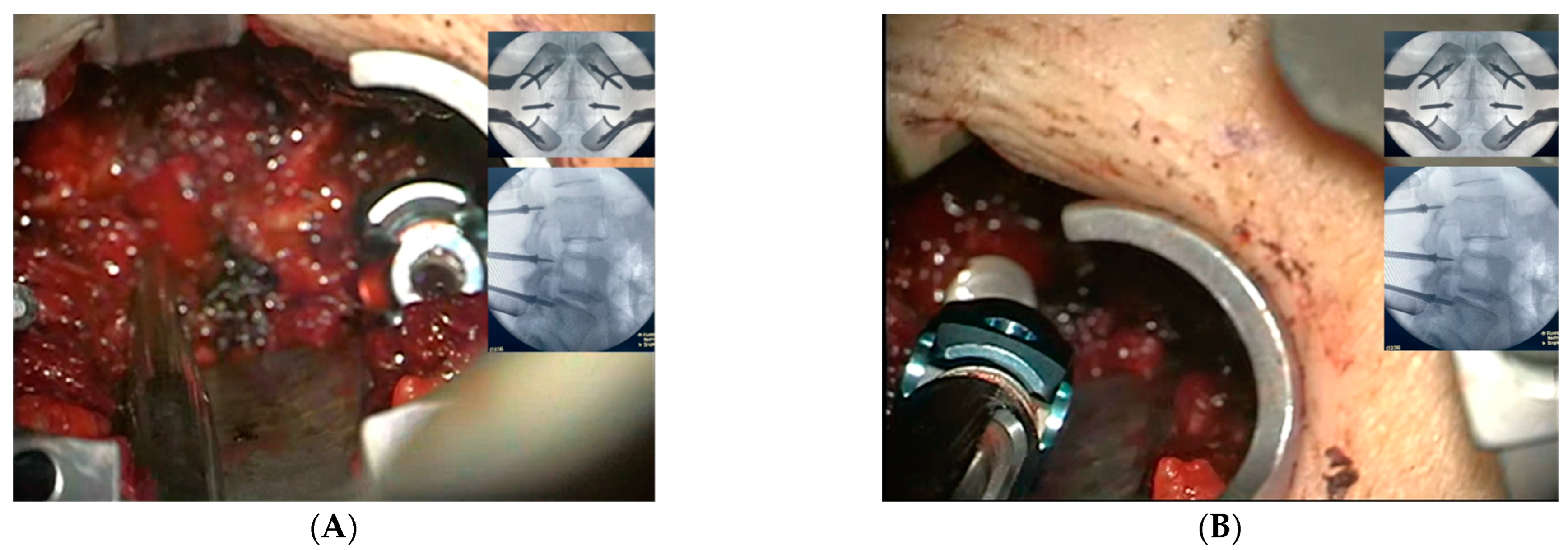 Medicina 59 00585 g003 Medicina 59 00585 g003