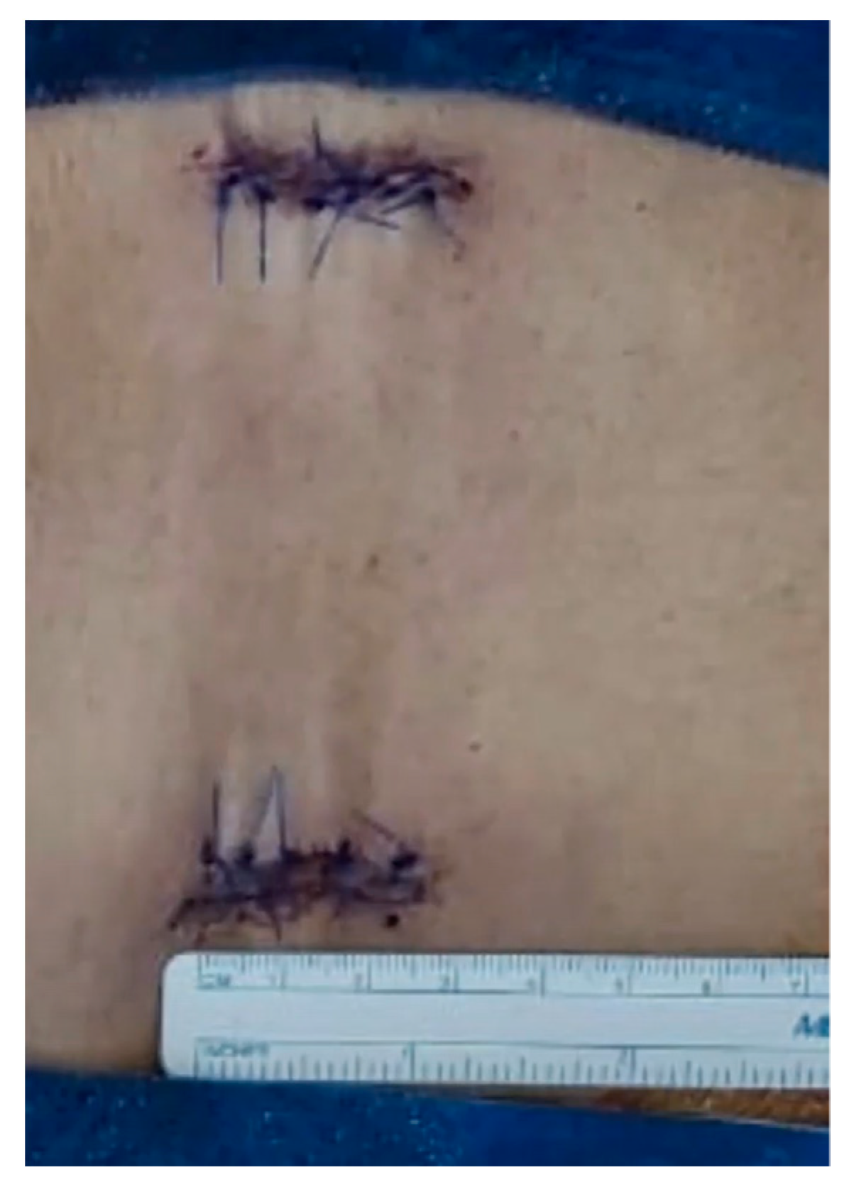 Medicina 59 00585 g005 Medicina 59 00585 g005