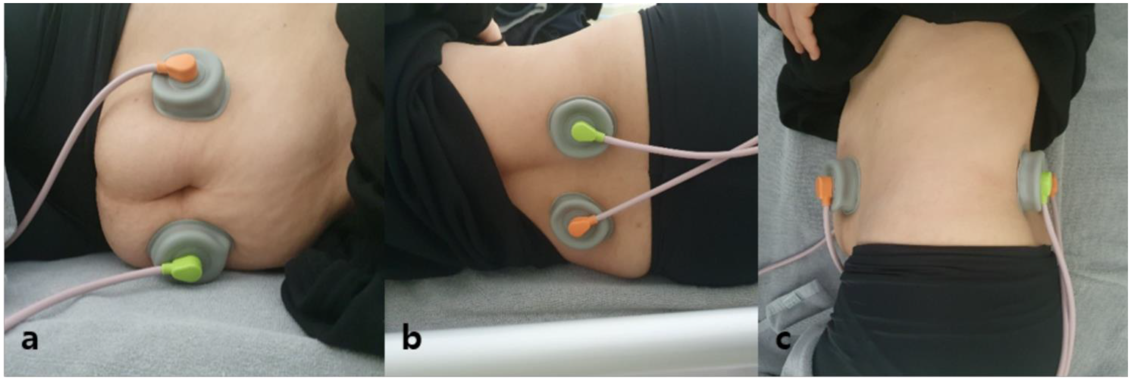 Electrode placement for home-based interferential electrical