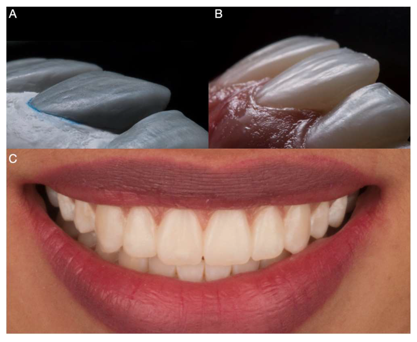 Medicina 59 00603 g002