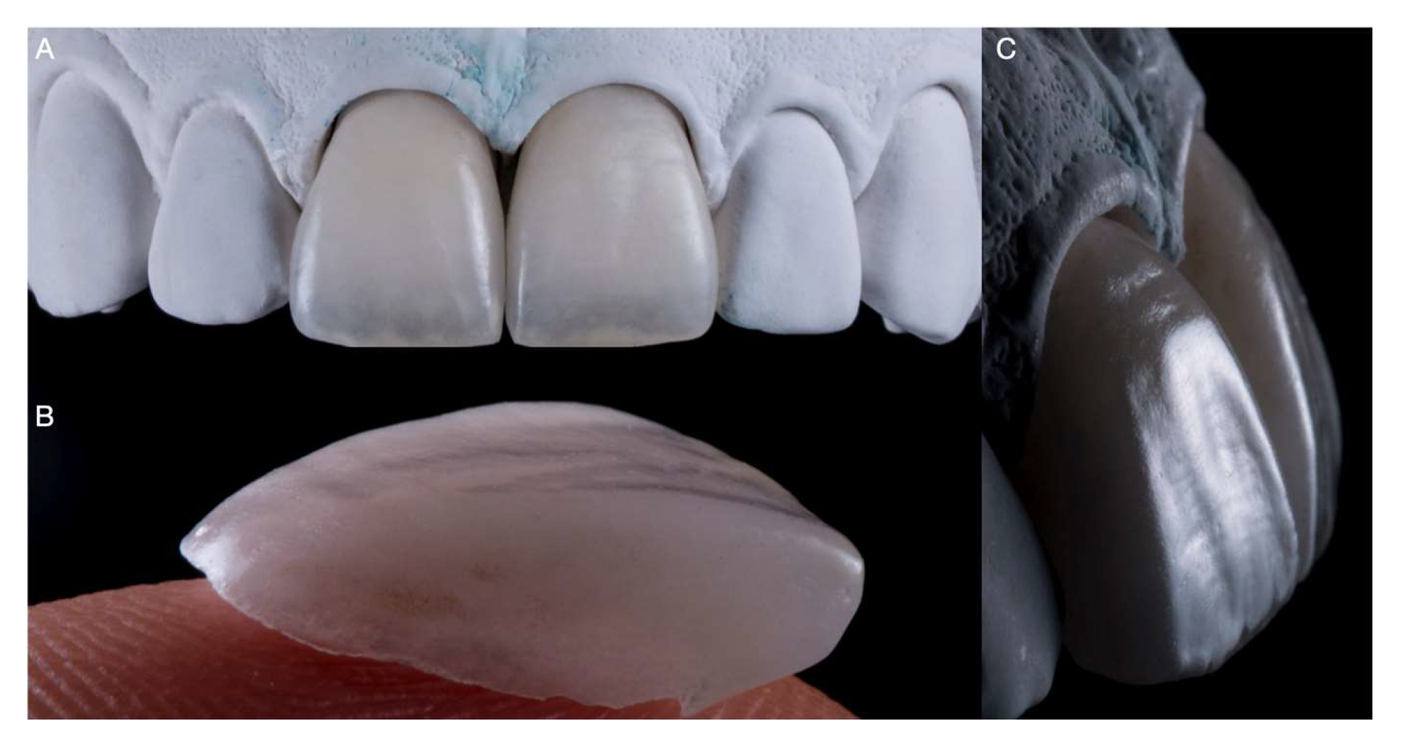 Medicina 59 00603 g005