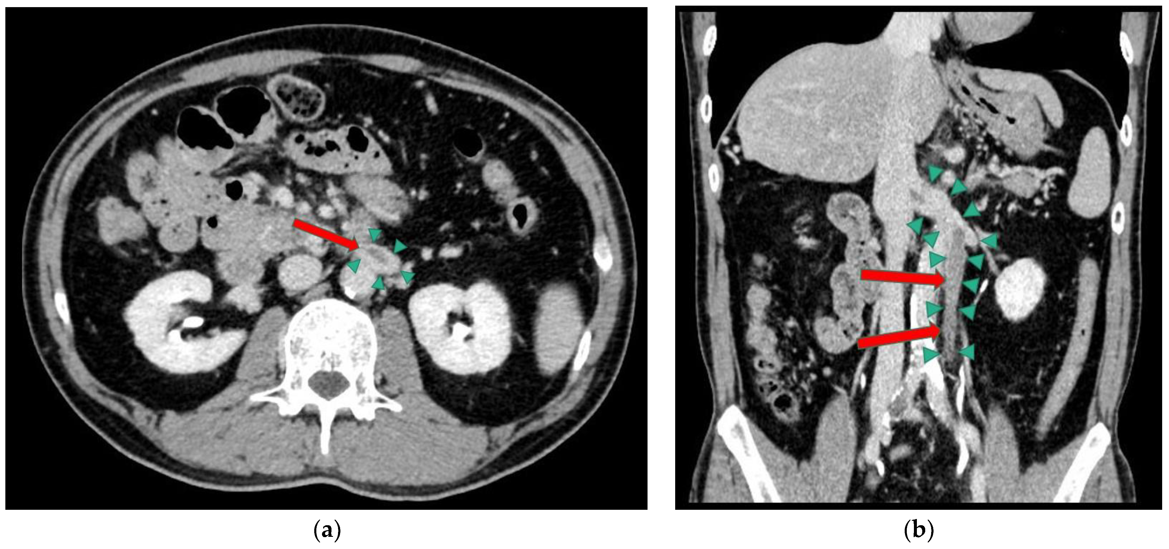 Medicina 59 00605 g004