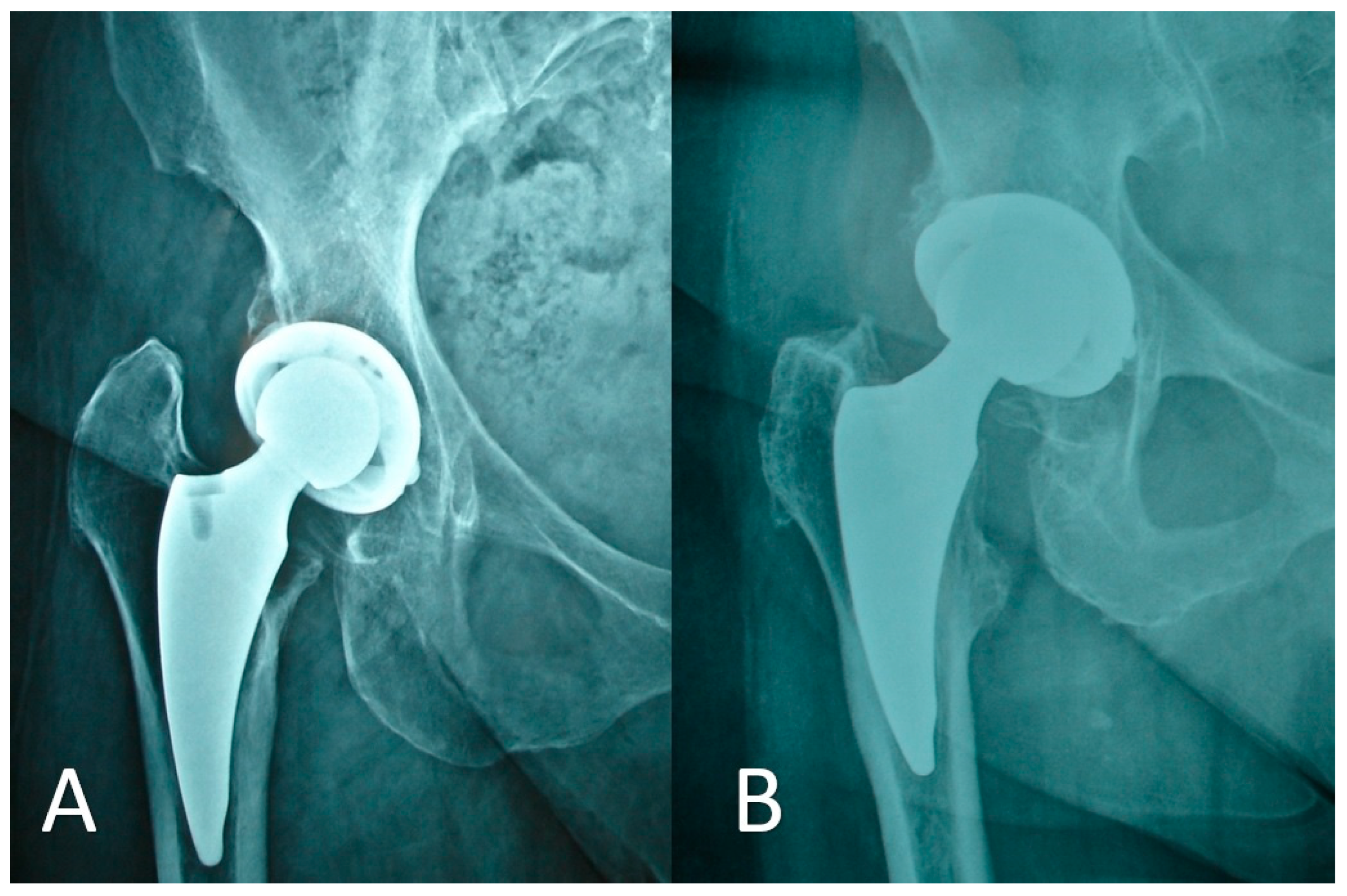 Medicina 59 00607 g004 Medicina 59 00607 g004
