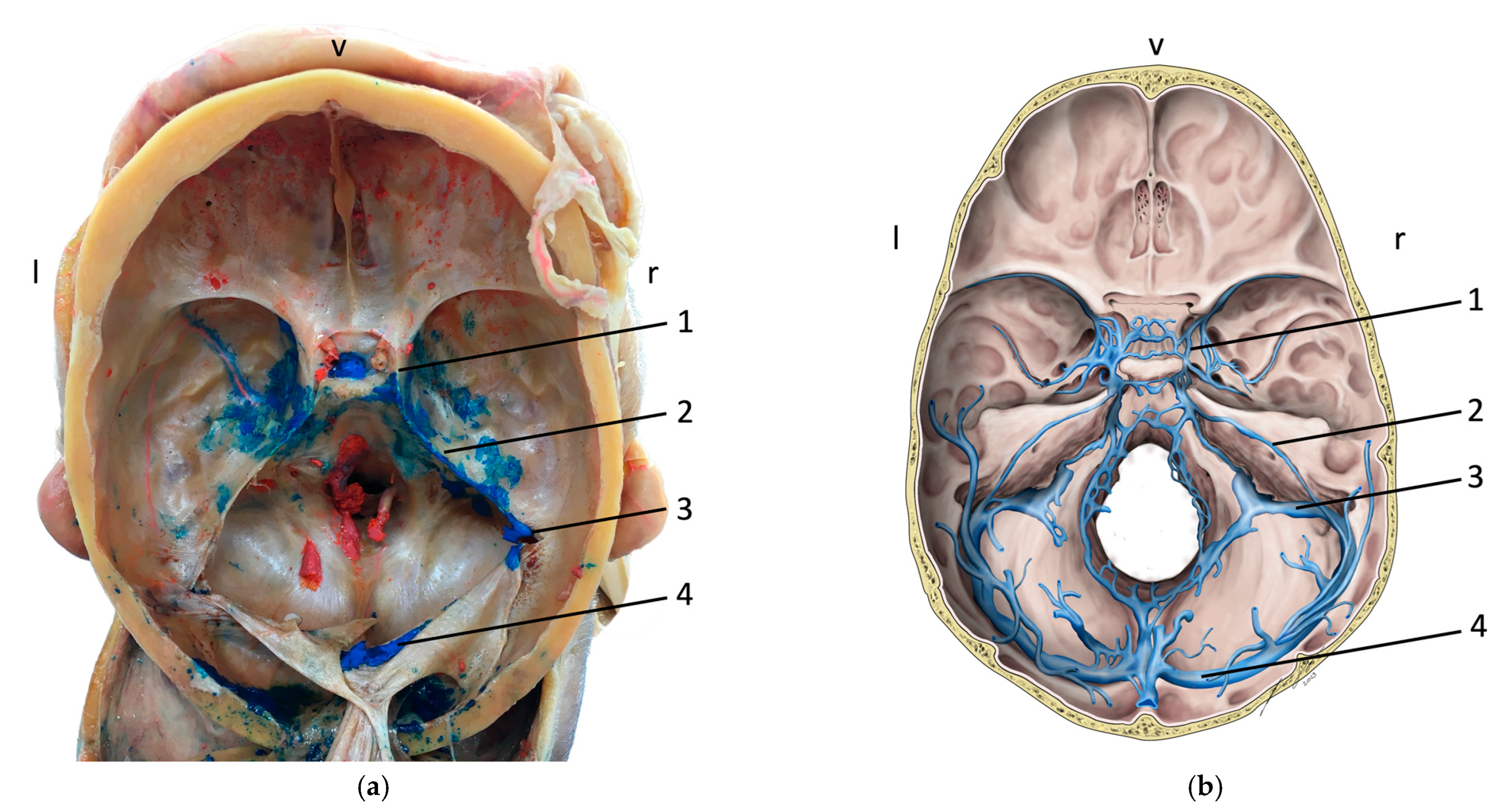 Medicina 59 00609 g002