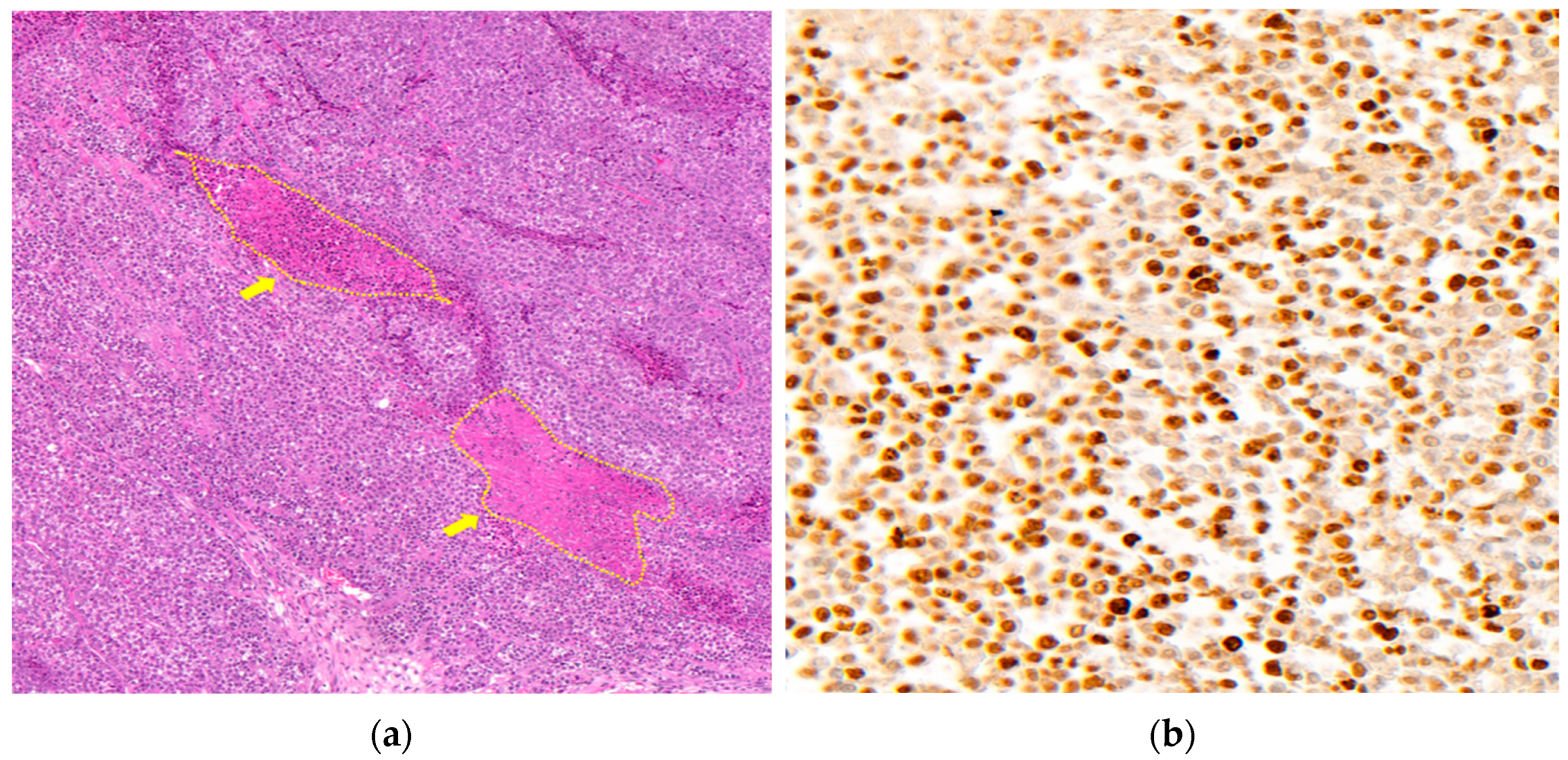 Medicina 59 00613 g006 Medicina 59 00613 g006