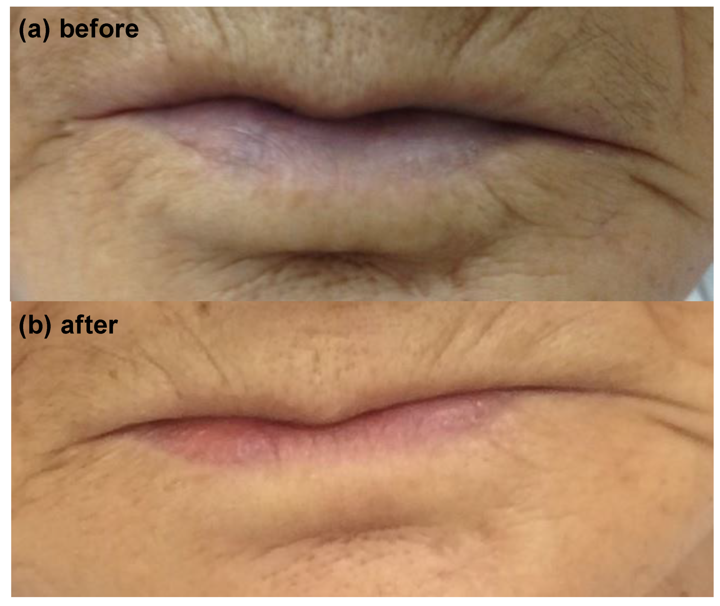 Medicina 59 00615 g005