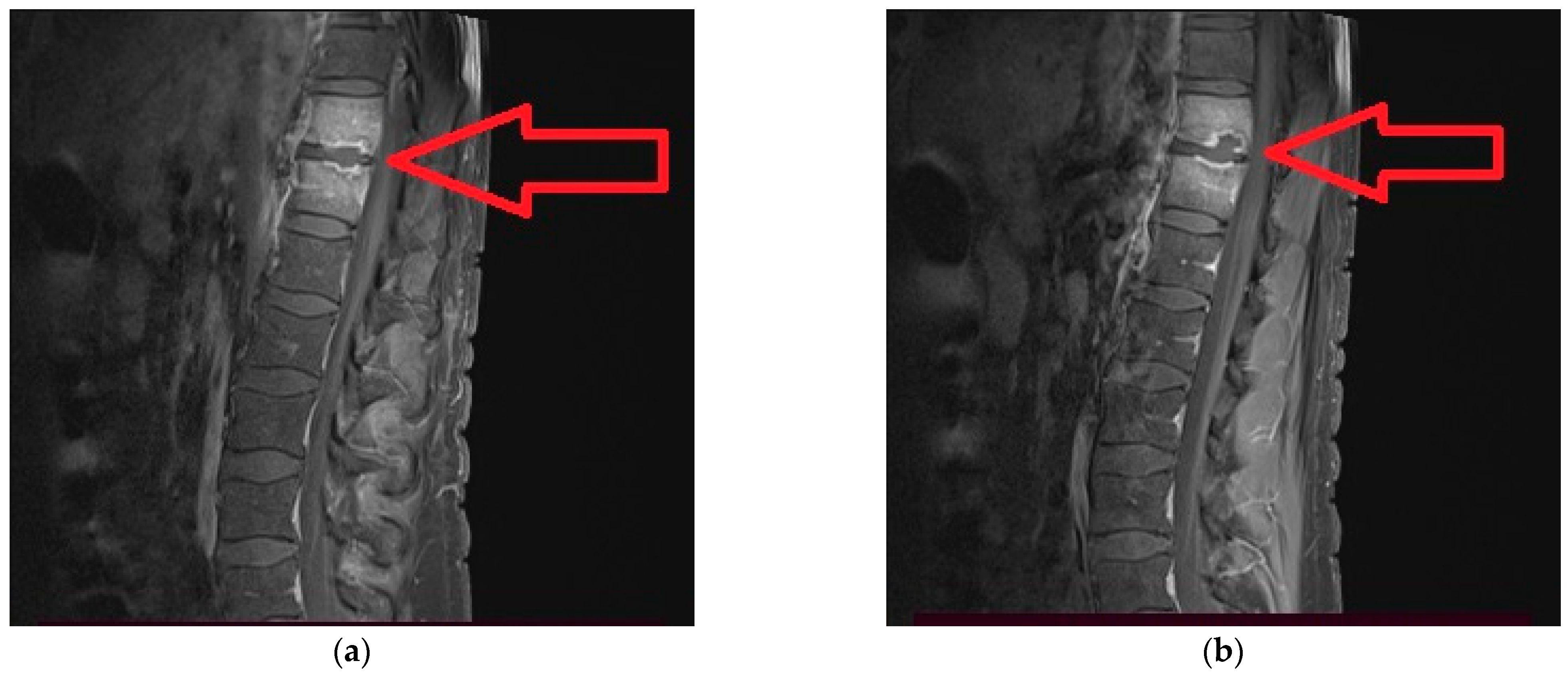 Medicina 59 00616 g002 Medicina 59 00616 g002