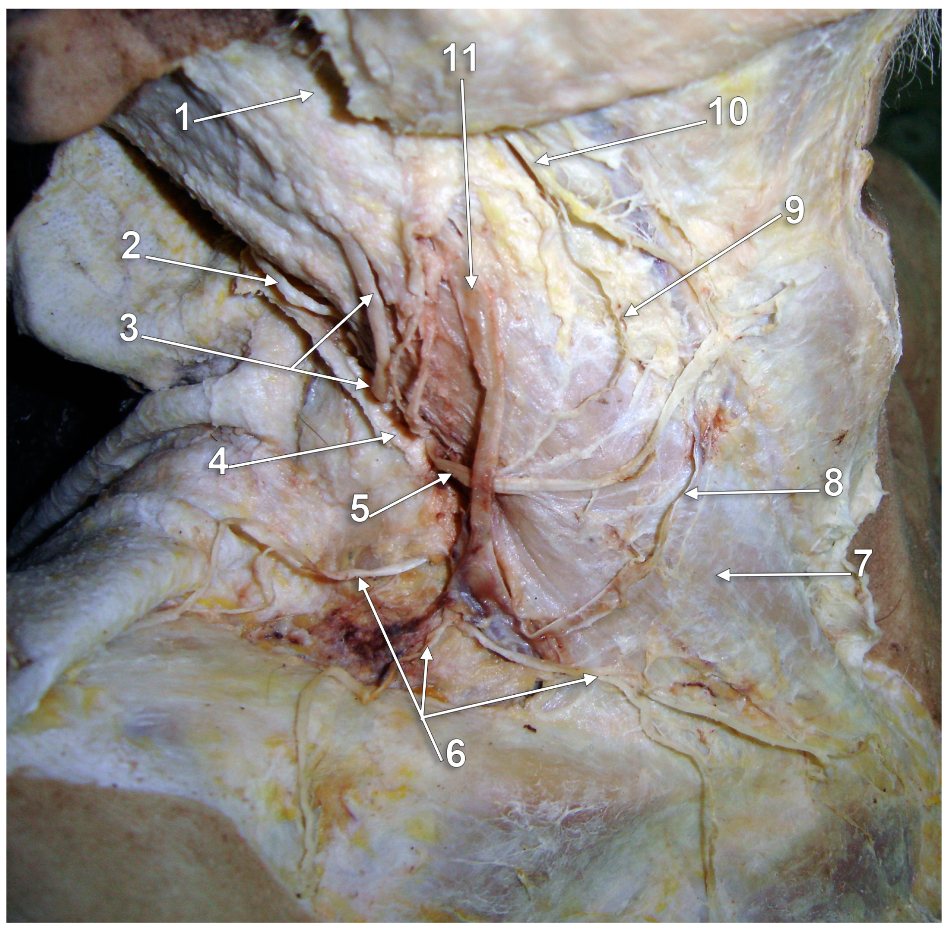 Medicina 59 00622 g001 Medicina 59 00622 g001