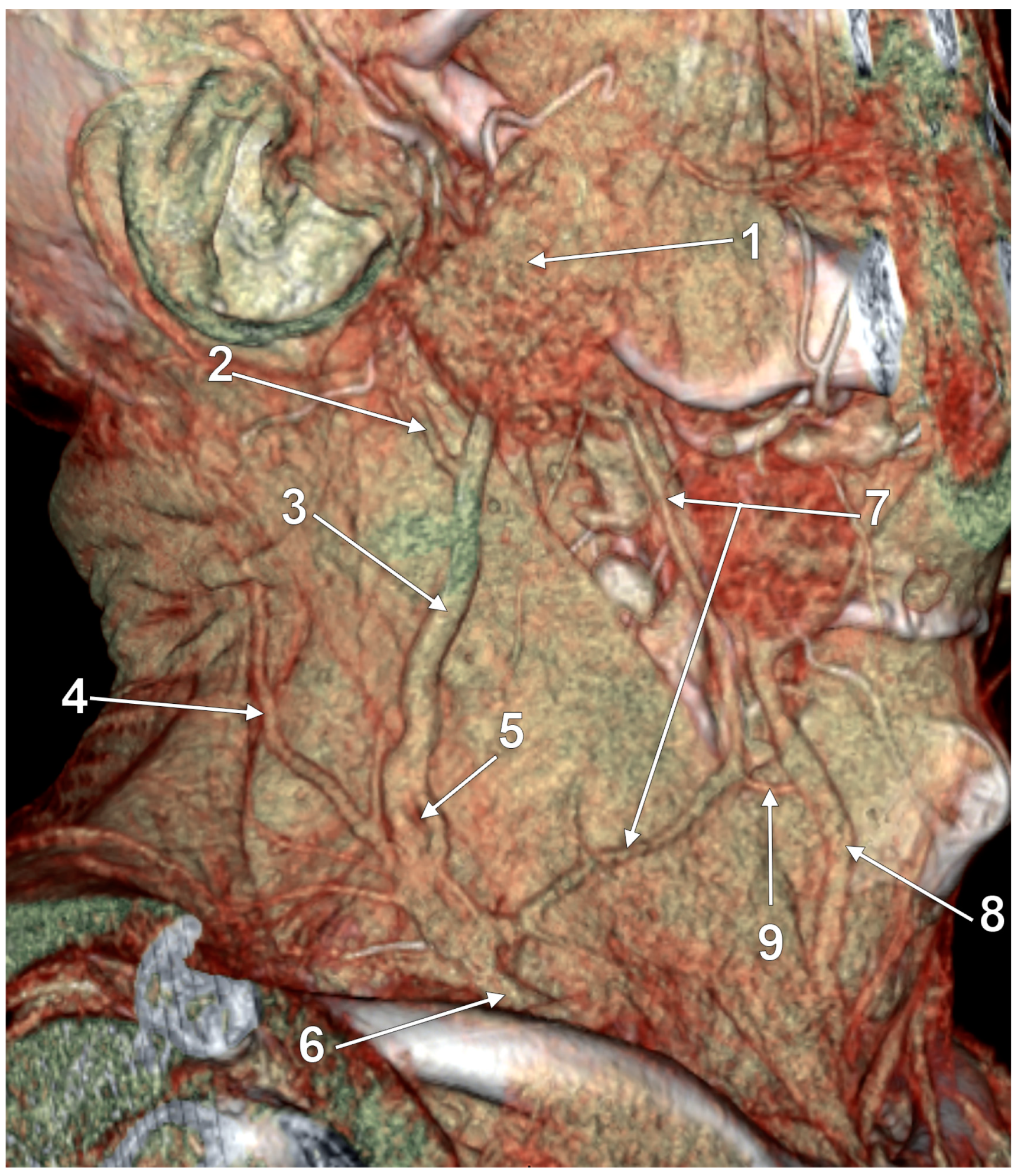 Medicina 59 00622 g007 Medicina 59 00622 g007