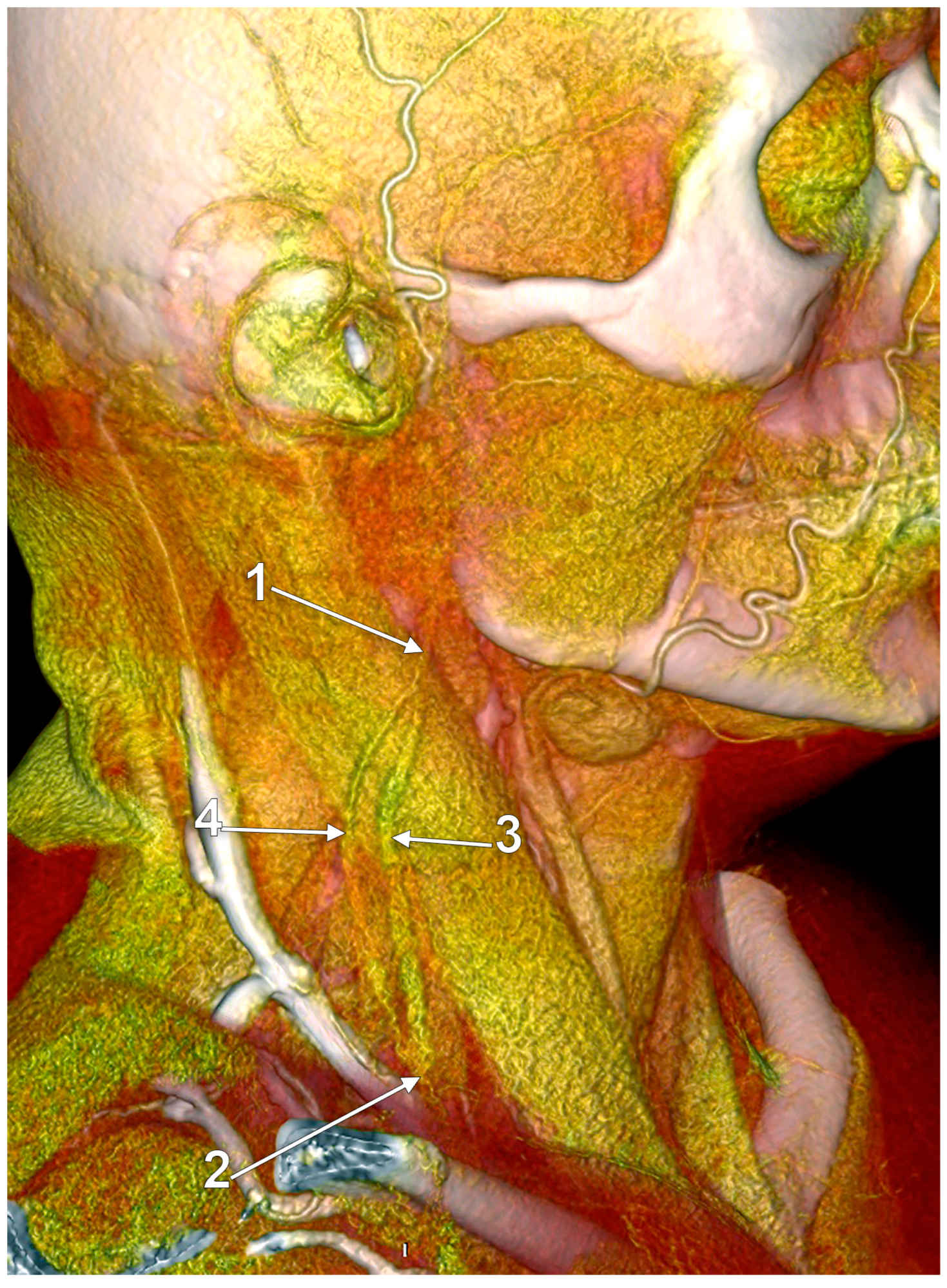 Medicina 59 00622 g010 Medicina 59 00622 g010