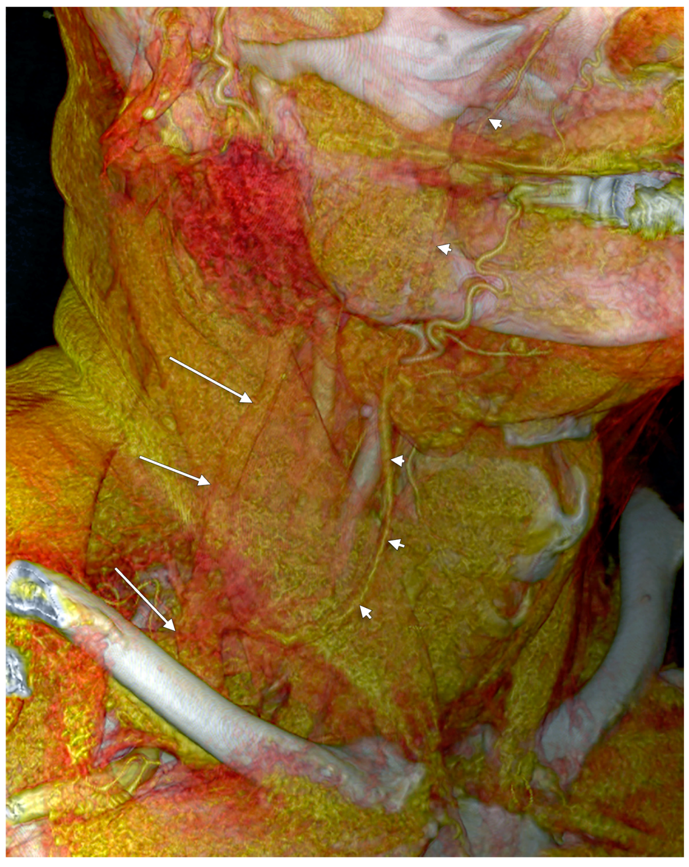 Medicina 59 00622 g014 Medicina 59 00622 g014