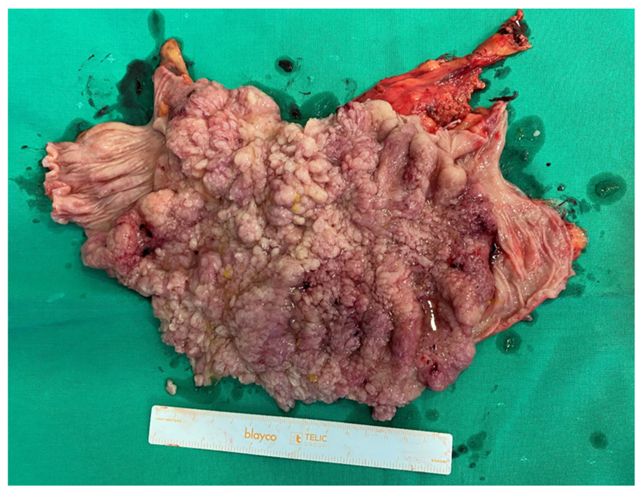 Medicina 59 00633 g002