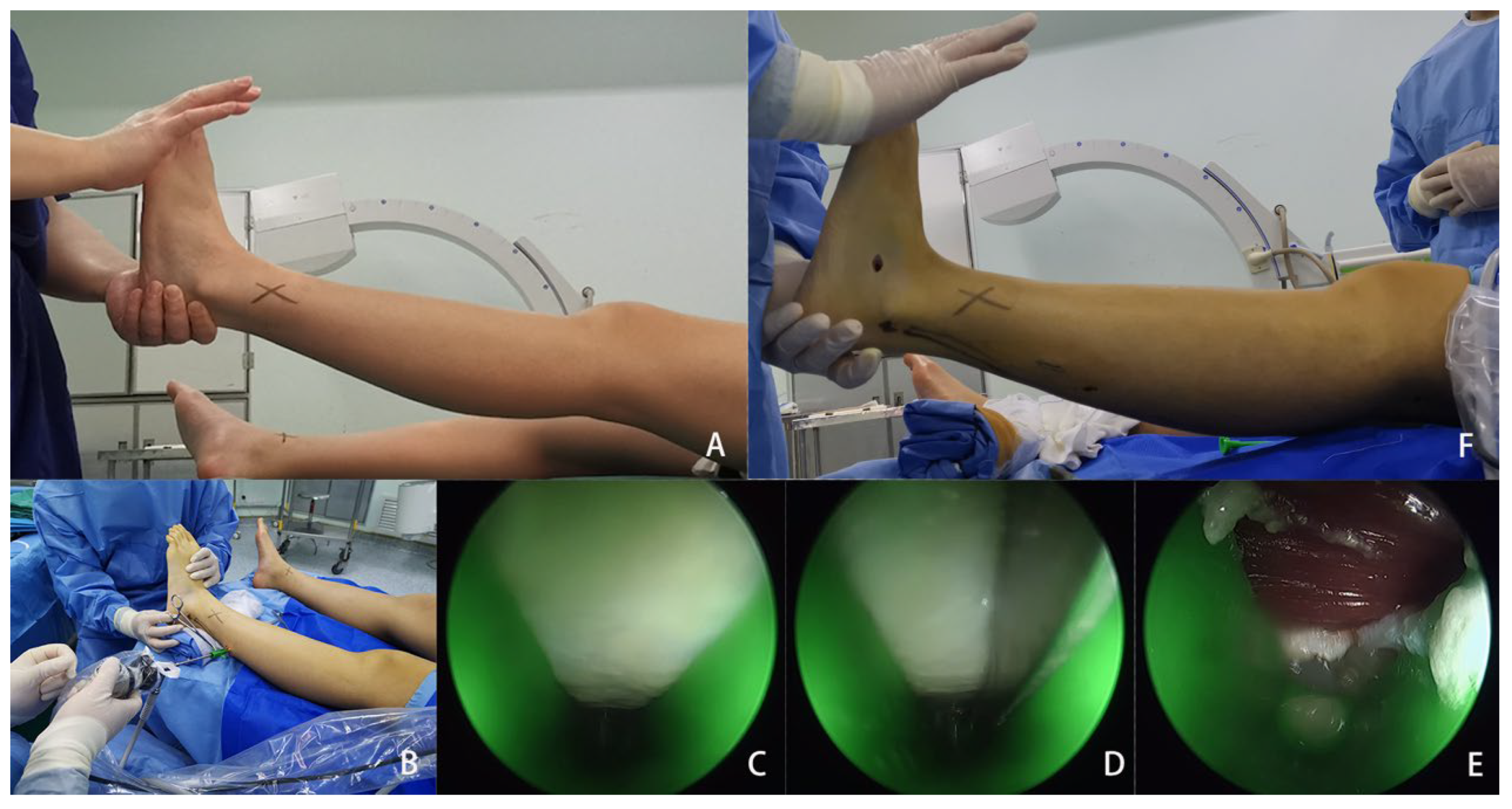 Medicina 59 00635 g002 550