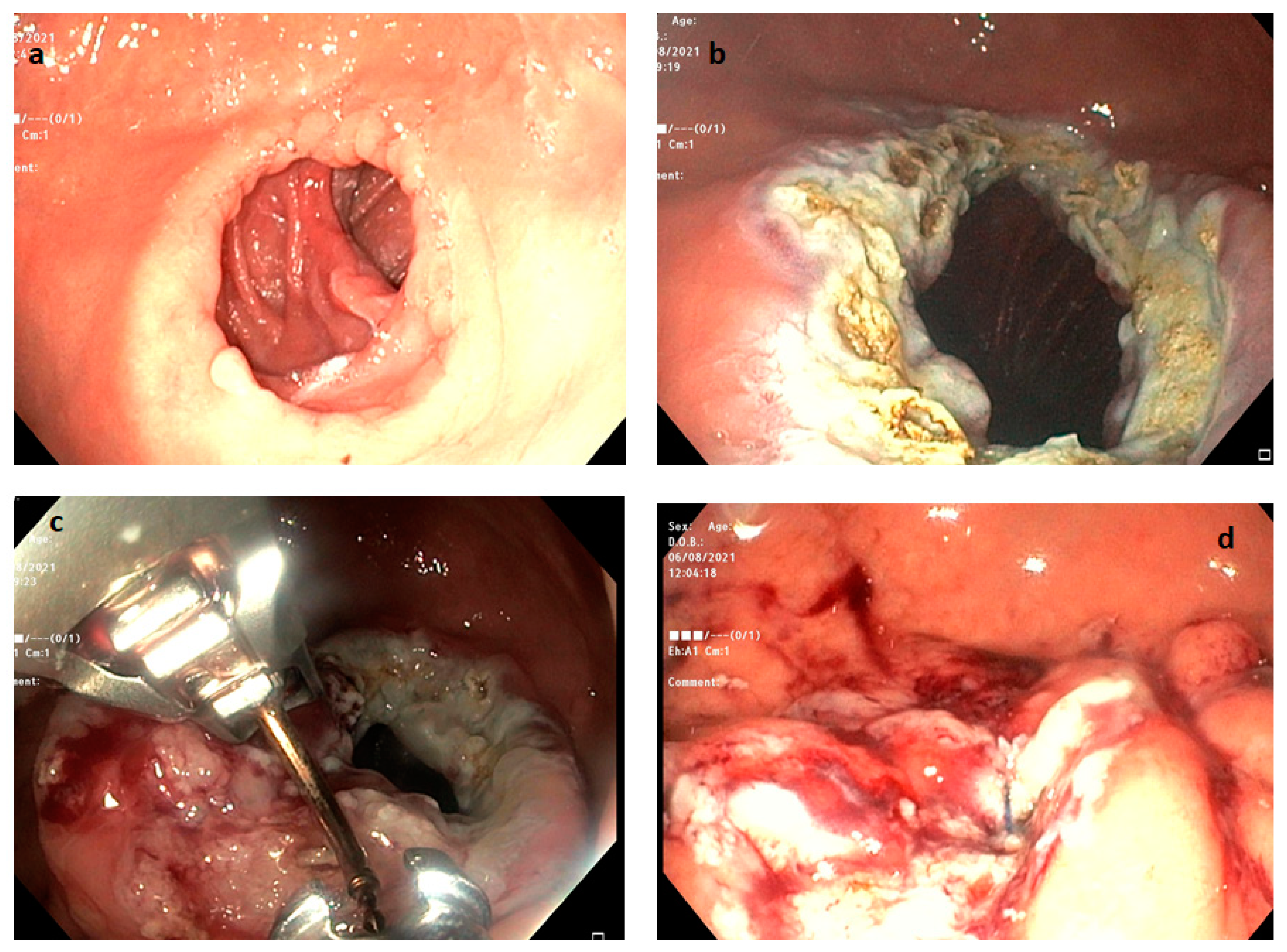 Medicina 59 00636 g003 Medicina 59 00636 g003
