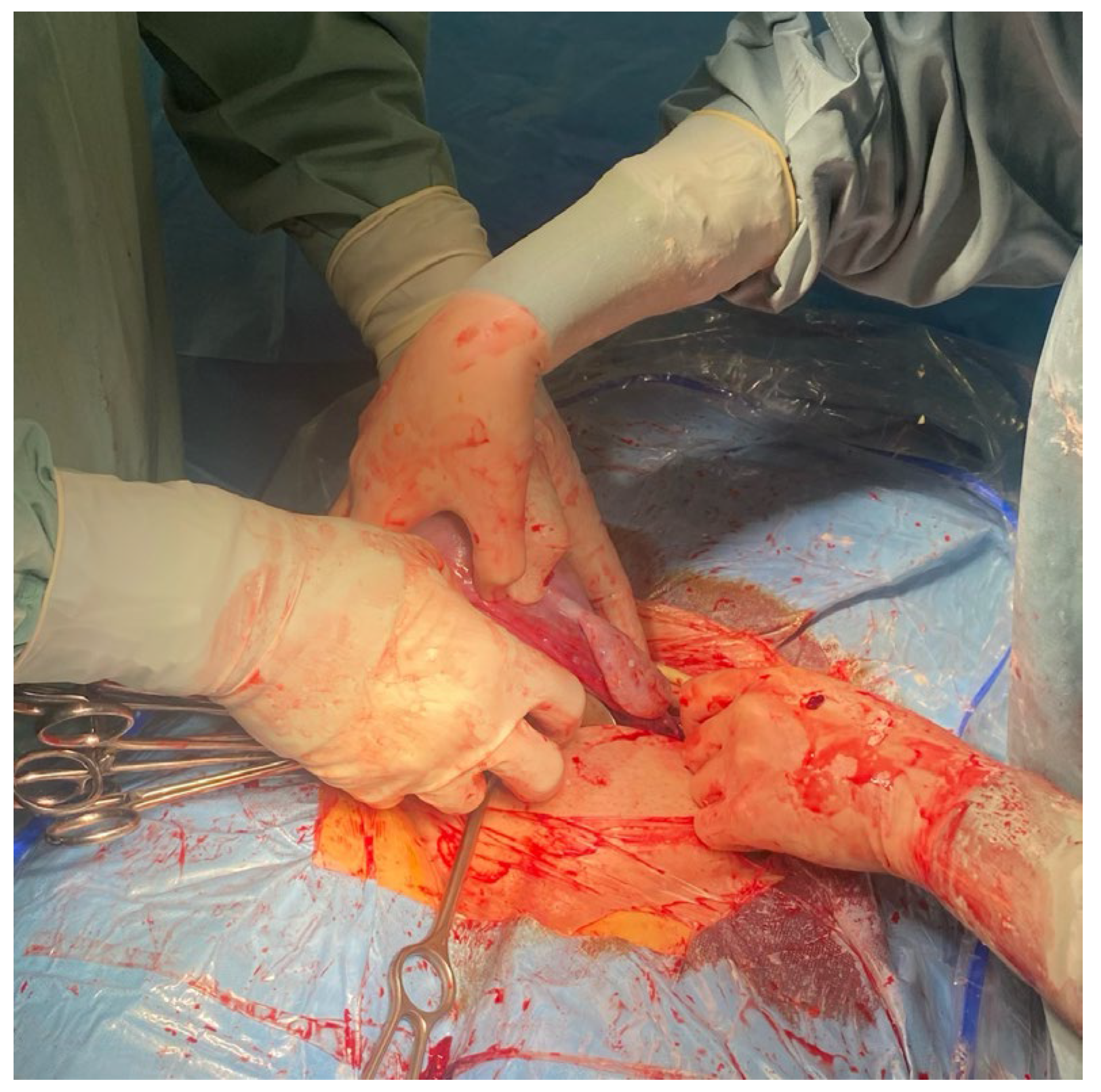 Medicina 59 00641 g002