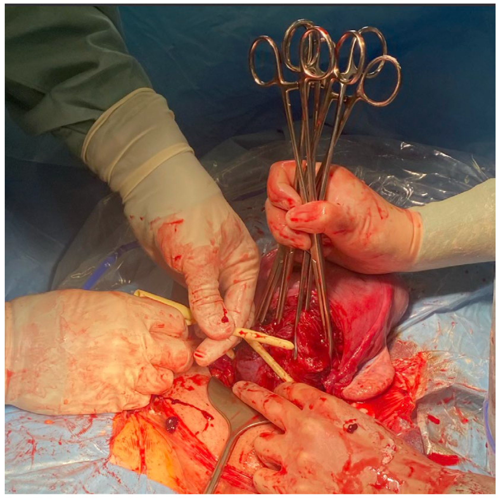 Medicina 59 00641 g004