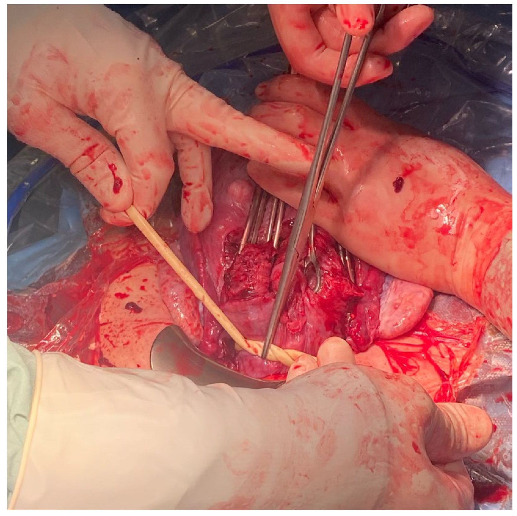 Medicina 59 00641 g006