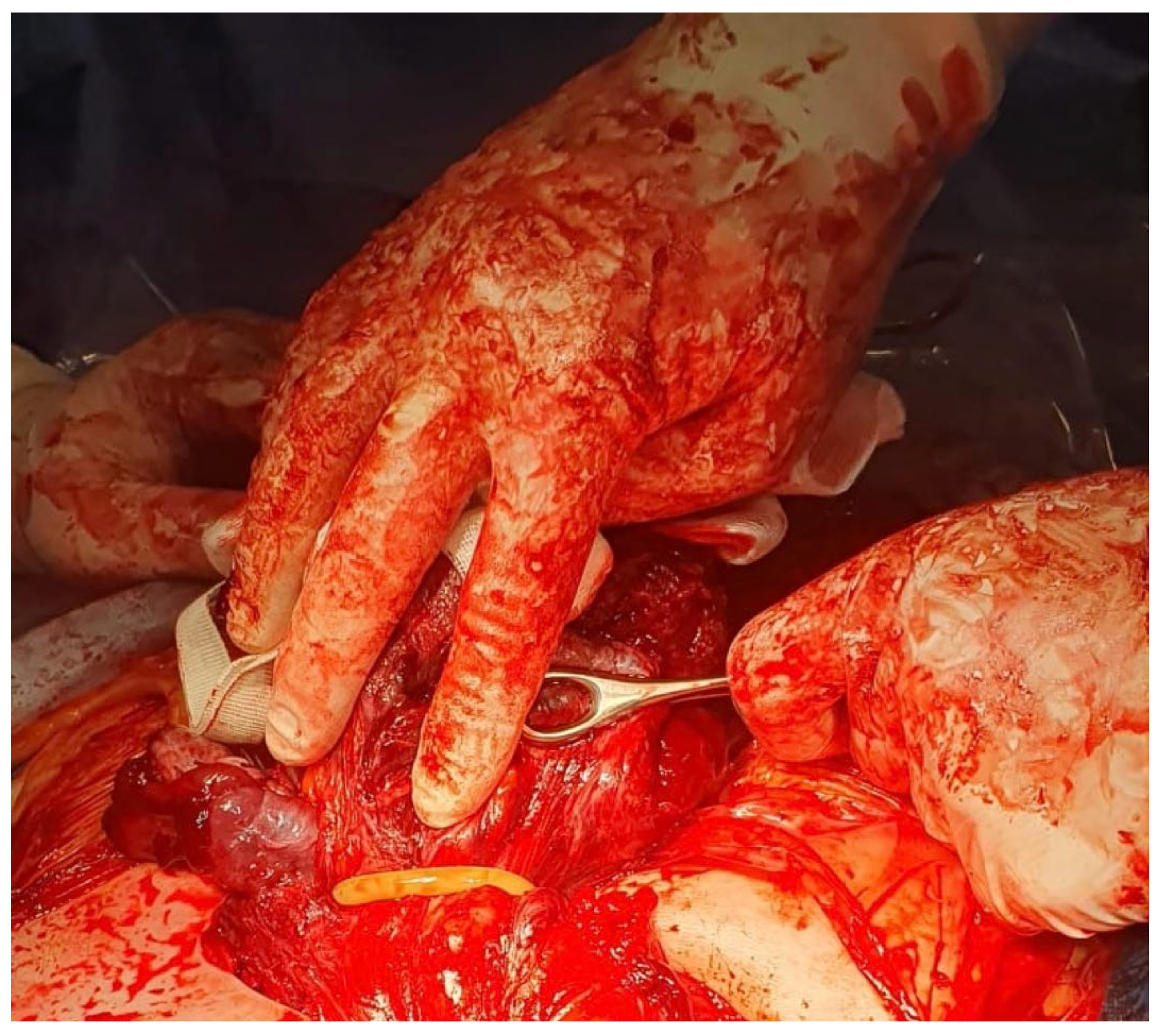 Medicina 59 00641 g007