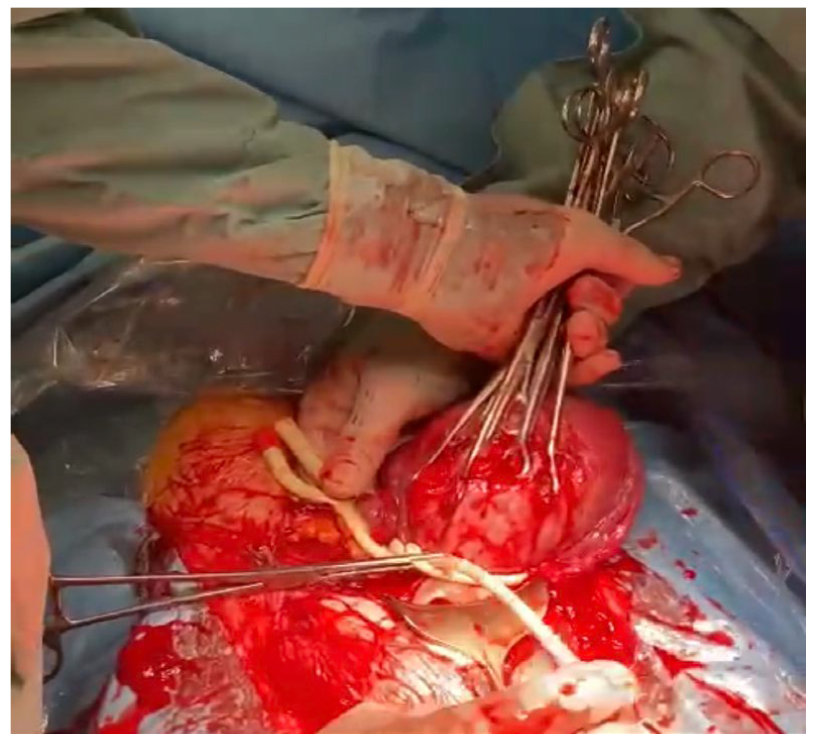 Medicina 59 00641 g010