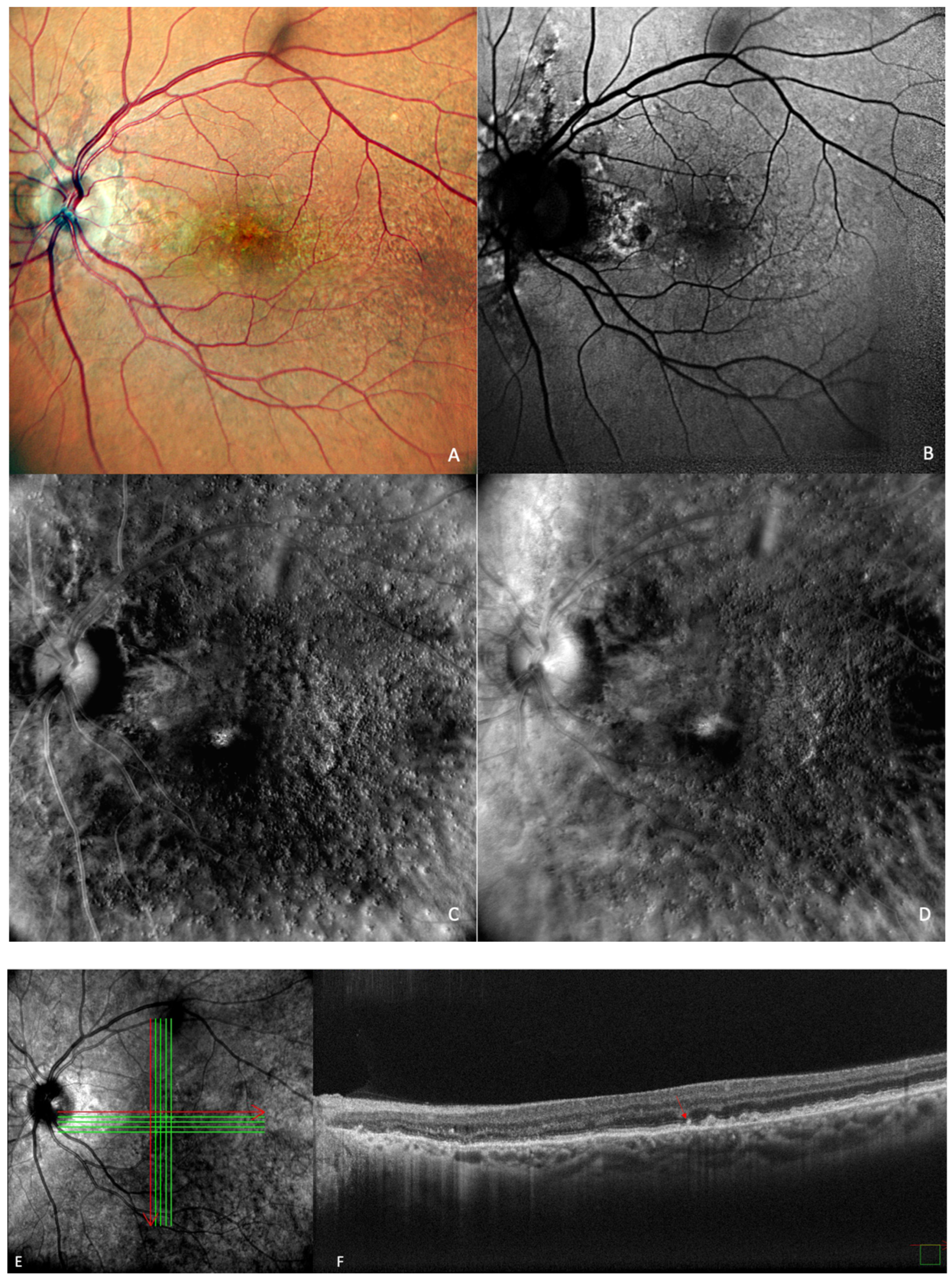 Medicina 59 00647 g005