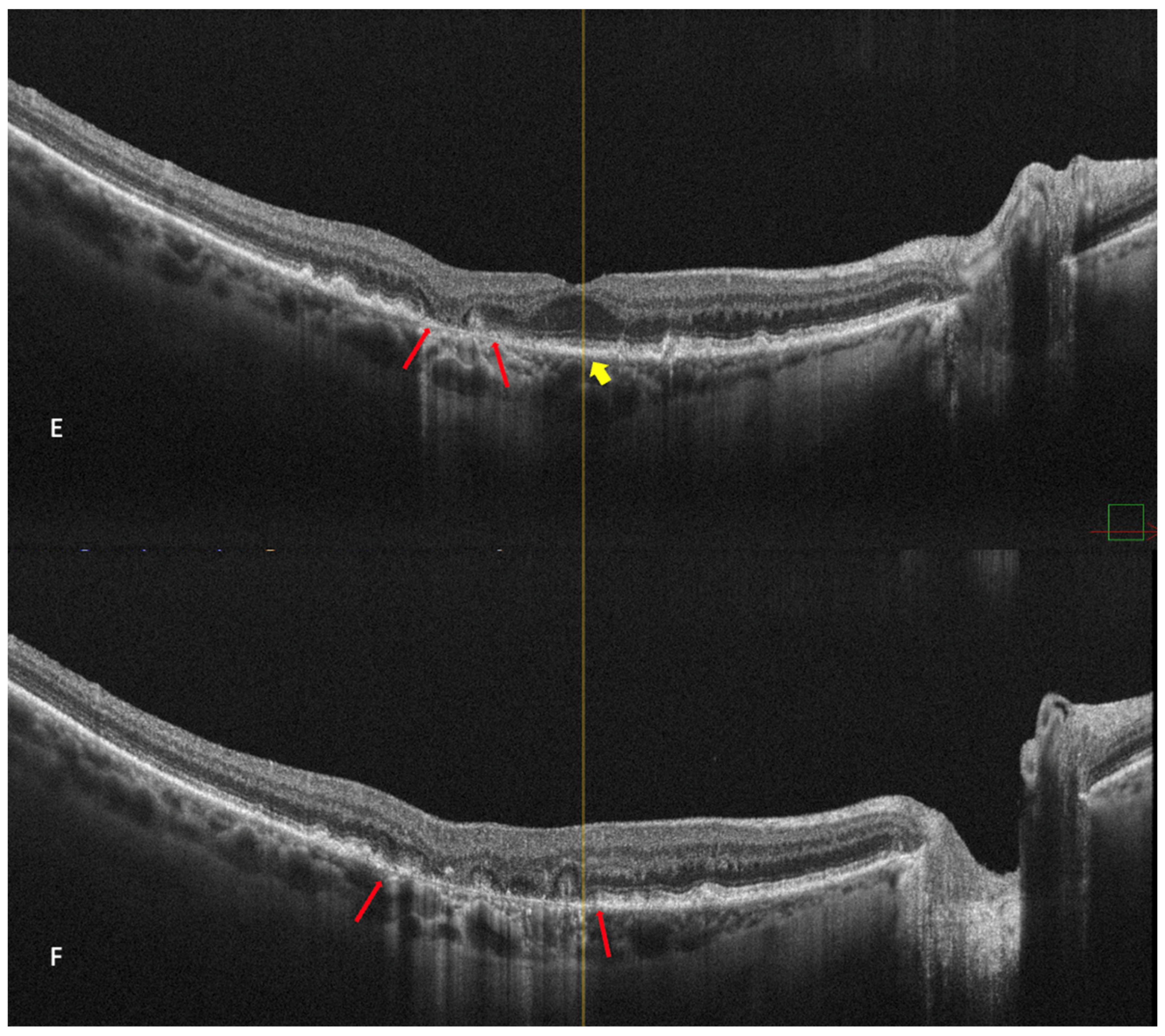 Medicina 59 00647 g006b