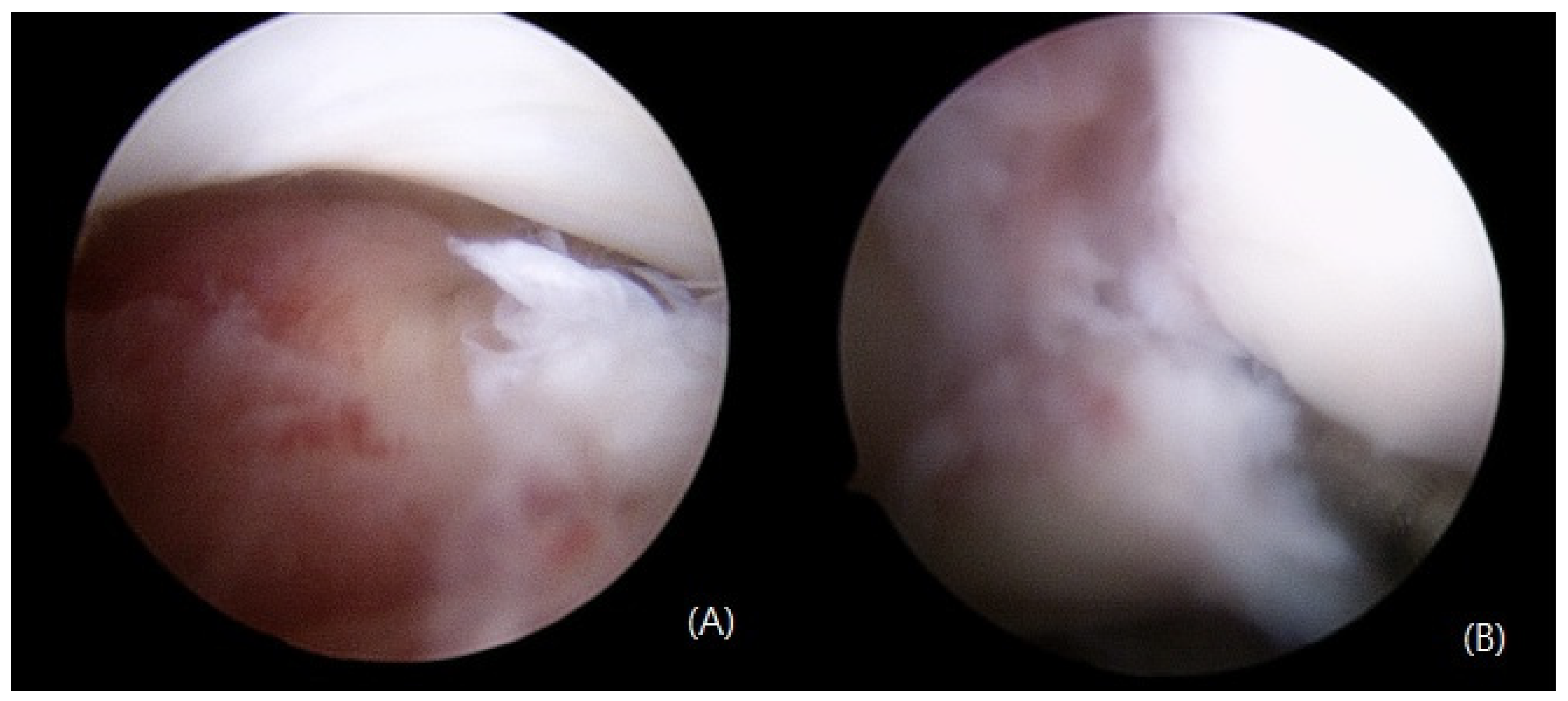 Medicina 59 00652 g004