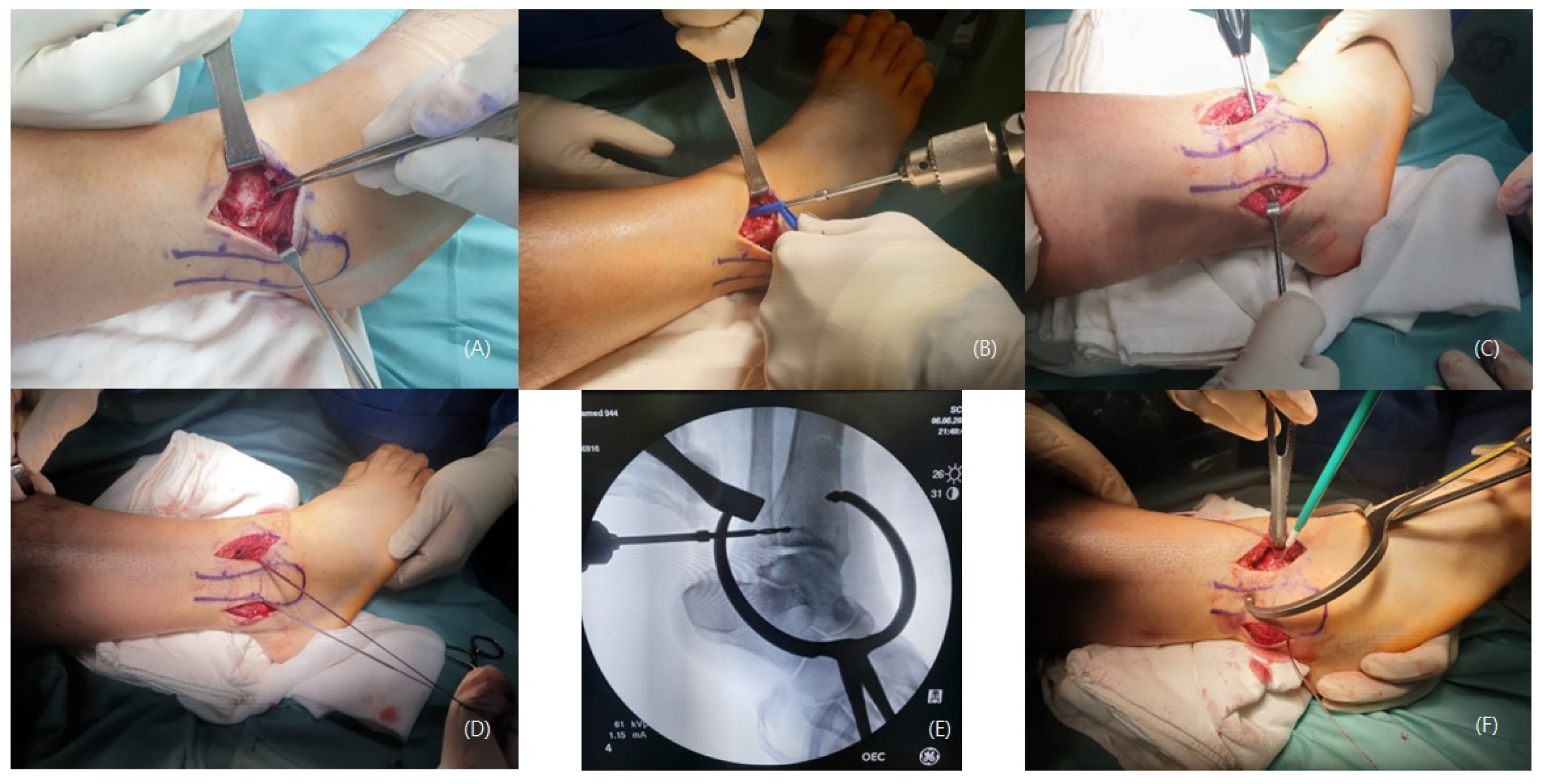 Medicina 59 00652 g005