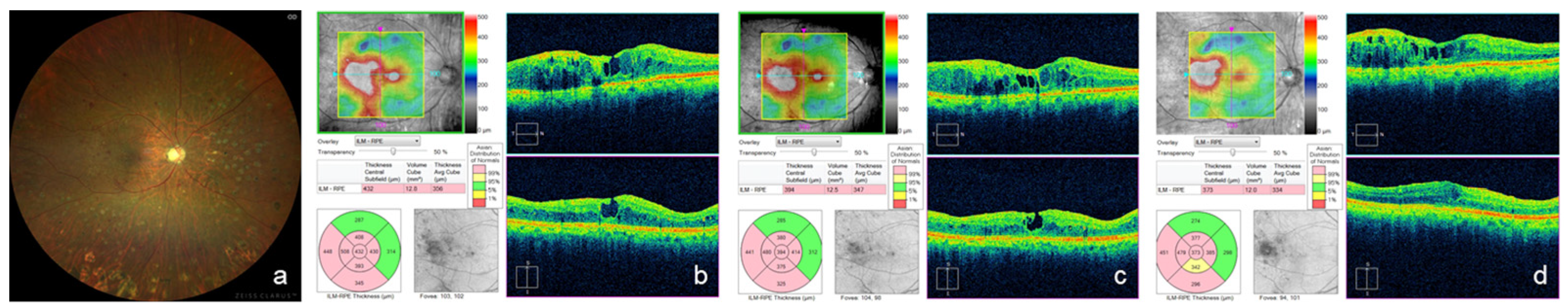 Medicina 59 00665 g005